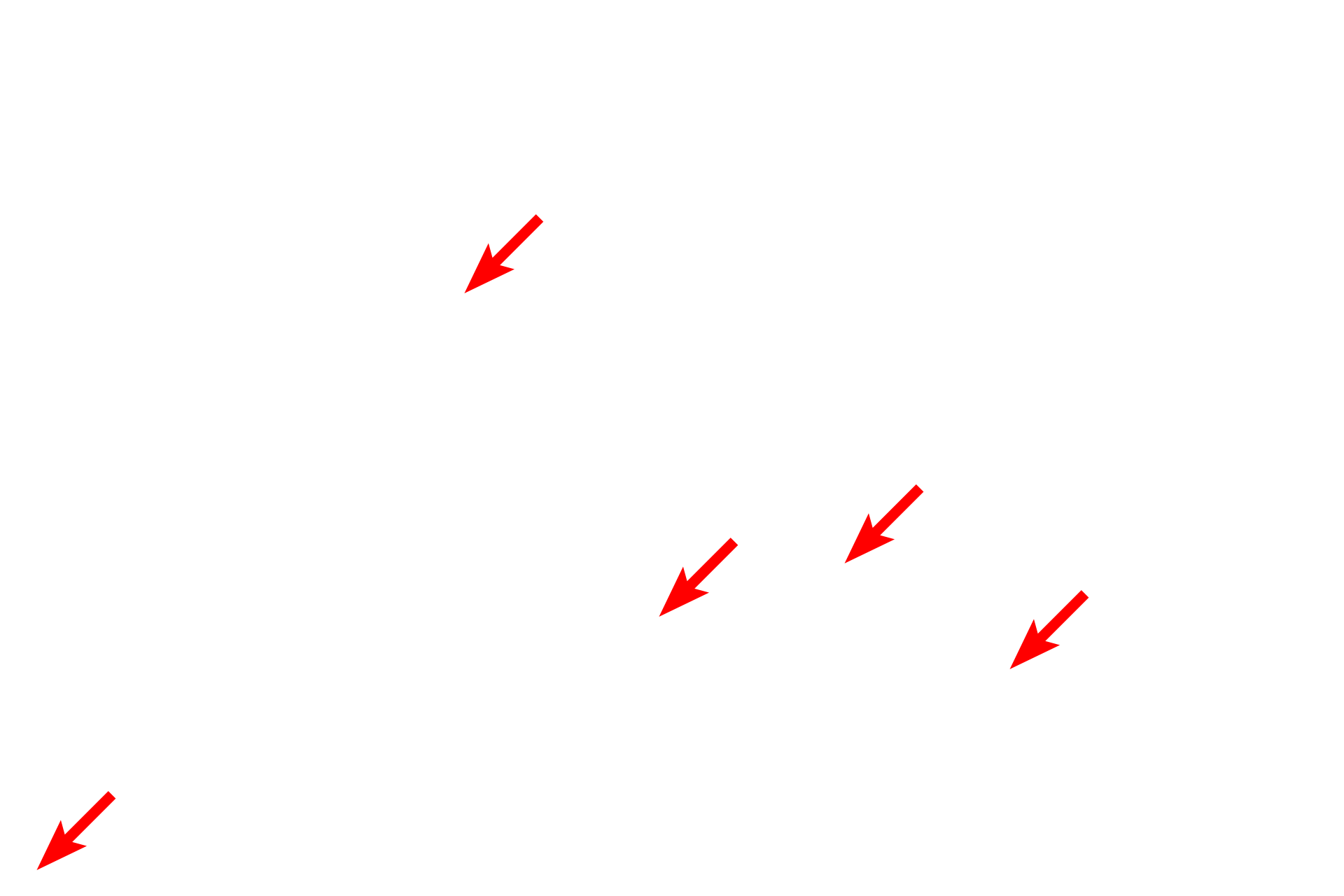 Bowman’s space <p>The thick basal lamina is formed by fusion of the individual podocyte and endothelial cell basal laminae. This layer plays a critical role in the glomerular filtration process as fluid leaves the capillary lumen and enters Bowman’s space.</p>
