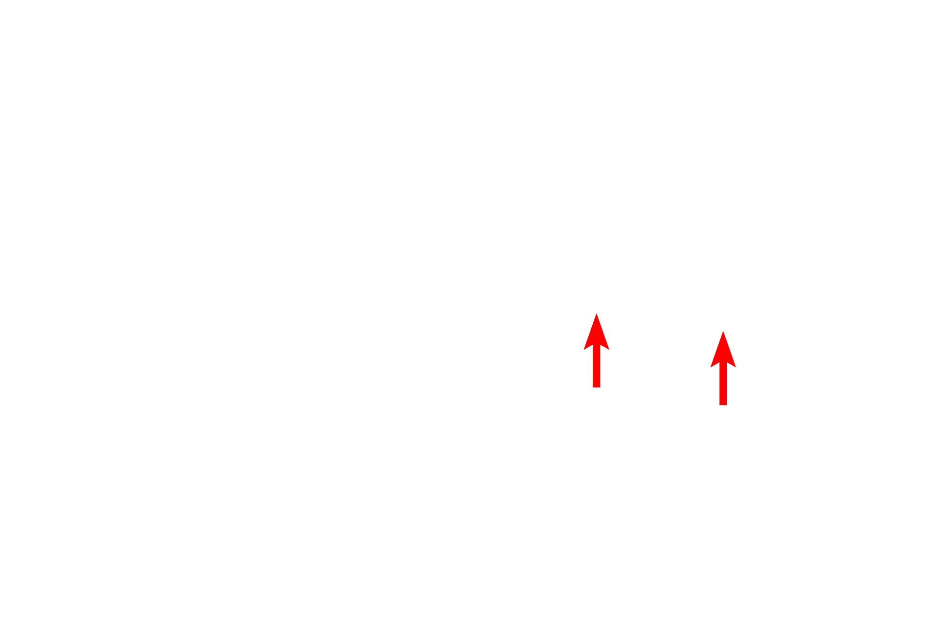  - Primary process <p>The pedicels of a podocyte contact the thick, combined basal laminae of the endothelial cell and the podocyte.  The pedicels of one podocyte interdigitate with those from a different podocyte.  In many cases, the connection of the pedicel with the primary process is not visible.  The endothelium of the capillaries is widely fenestrated and lacks the diaphragms commonly seen in other fenestrated capillaries.  14,000x</p>
