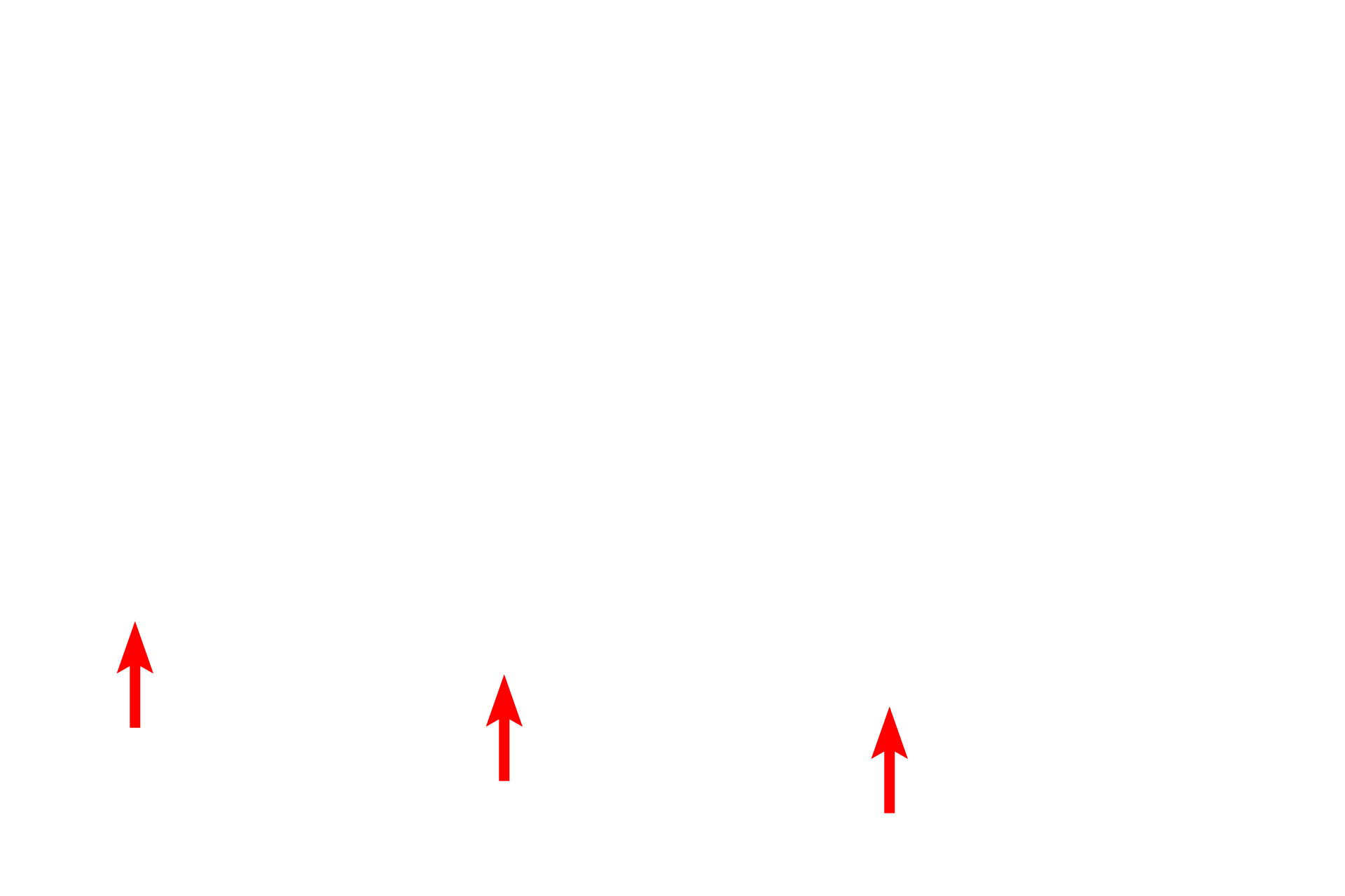 Podocyte primary process <p>The principal component of the filtration barrier of the glomerulus is the composite basal laminae of the endothelium and the podocyte.  The fenestrated endothelium of the glomerular capillaries lack the typical diaphragms.  Between alternating pedicels are filtration slits, that are spanned by a membrane that also regulates filtration.  30,000x</p>
