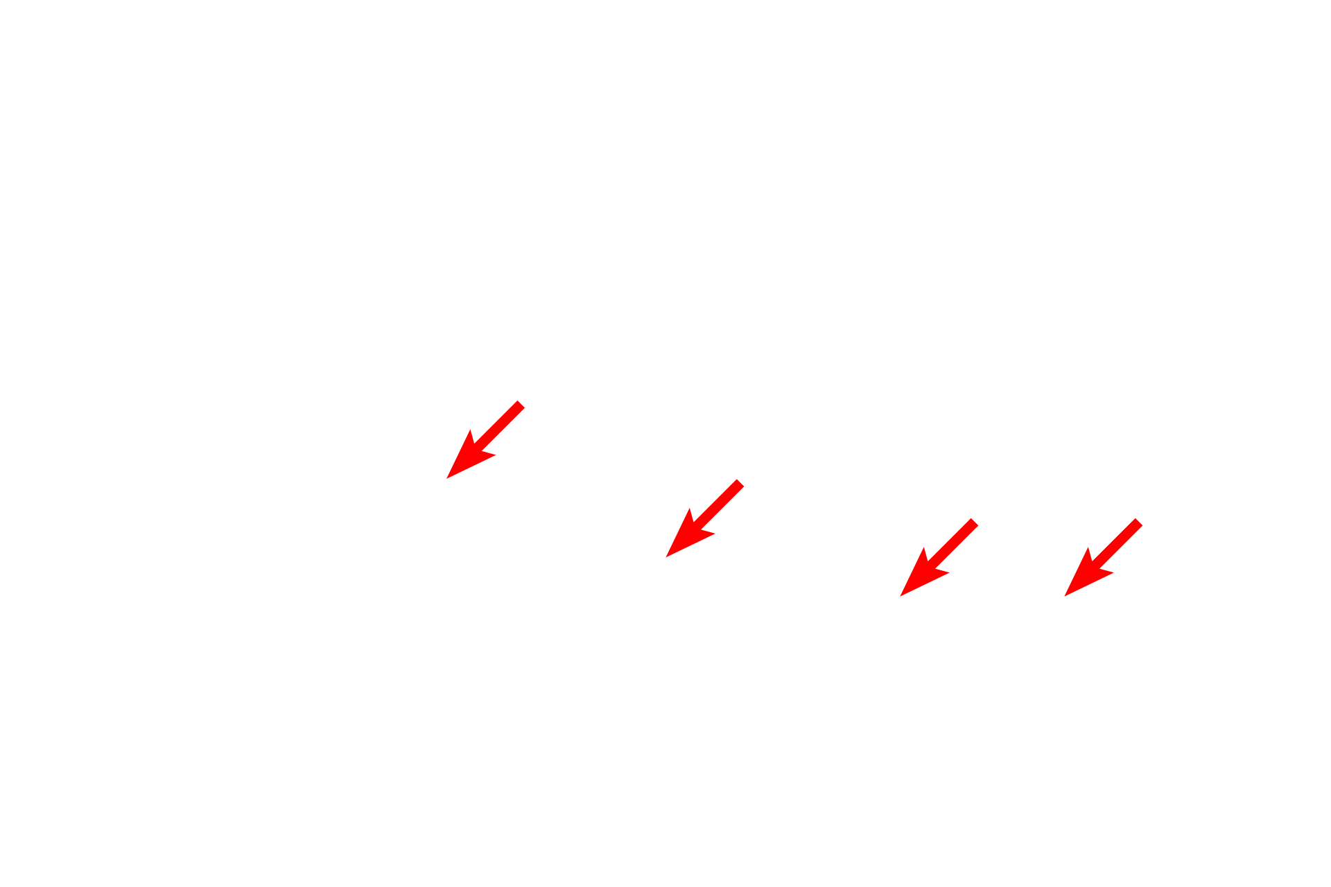  - Pedicels <p>The principal component of the filtration barrier of the glomerulus is the composite basal laminae of the endothelium and the podocyte.  The fenestrated endothelium of the glomerular capillaries lack the typical diaphragms.  Between alternating pedicels are filtration slits, that are spanned by a membrane that also regulates filtration.  30,000x</p>
