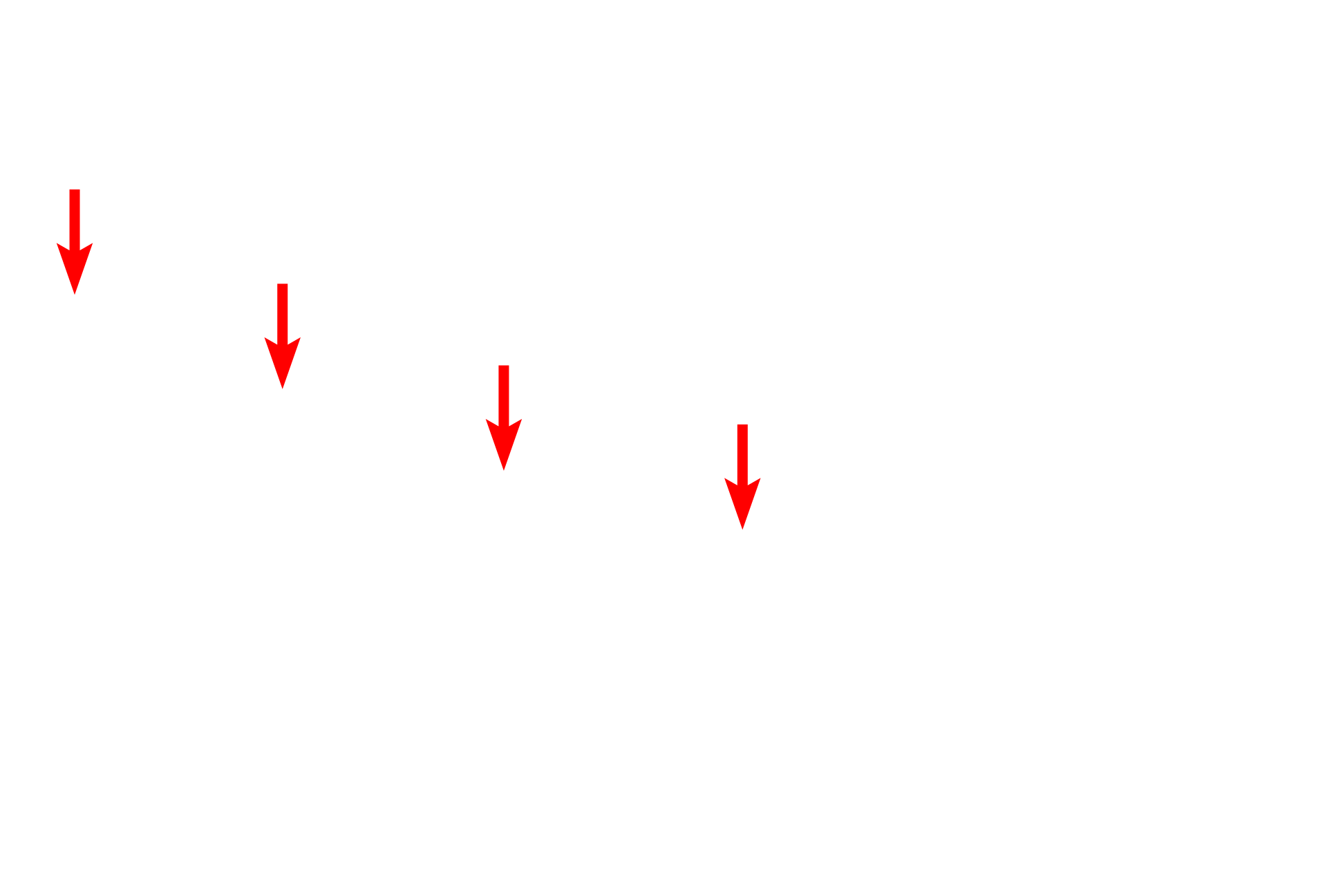  - Filtration slits <p>The principal component of the filtration barrier of the glomerulus is the composite basal laminae of the endothelium and the podocyte.  The fenestrated endothelium of the glomerular capillaries lack the typical diaphragms.  Between alternating pedicels are filtration slits, that are spanned by a membrane that also regulates filtration.  30,000x</p>
