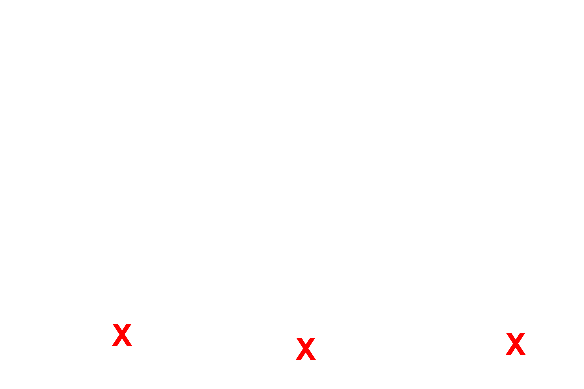 Bowman’s space <p>The principal component of the filtration barrier of the glomerulus is the composite basal laminae of the endothelium and the podocyte.  The fenestrated endothelium of the glomerular capillaries lack the typical diaphragms.  Between alternating pedicels are filtration slits, that are spanned by a membrane that also regulates filtration.  30,000x</p>
