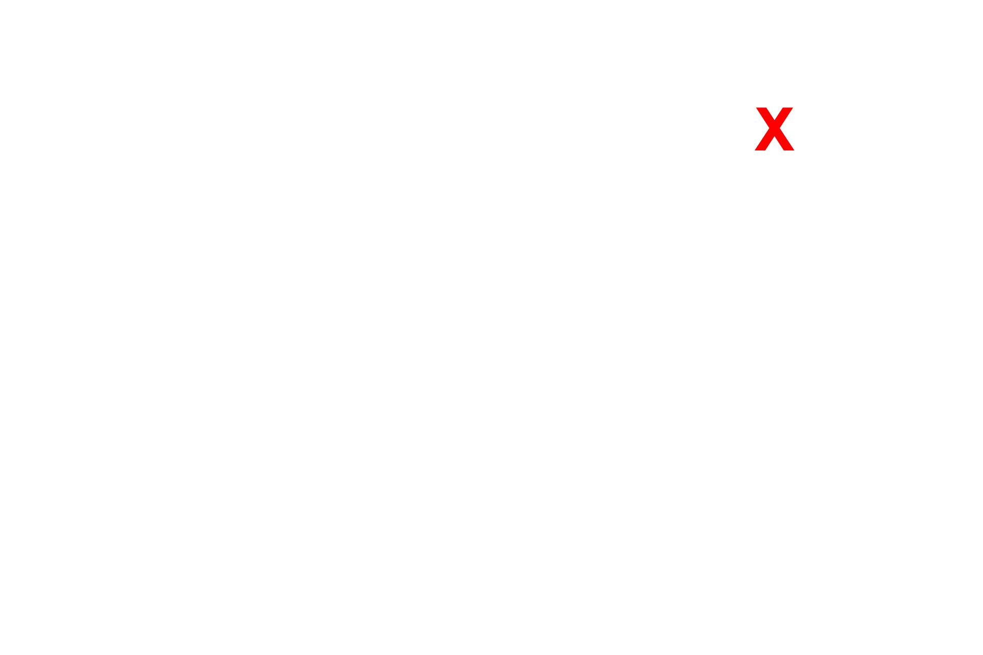 Glomerular capillary lumen <p>The principal component of the filtration barrier of the glomerulus is the composite basal laminae of the endothelium and the podocyte.  The fenestrated endothelium of the glomerular capillaries lack the typical diaphragms.  Between alternating pedicels are filtration slits, that are spanned by a membrane that also regulates filtration.  30,000x</p>

