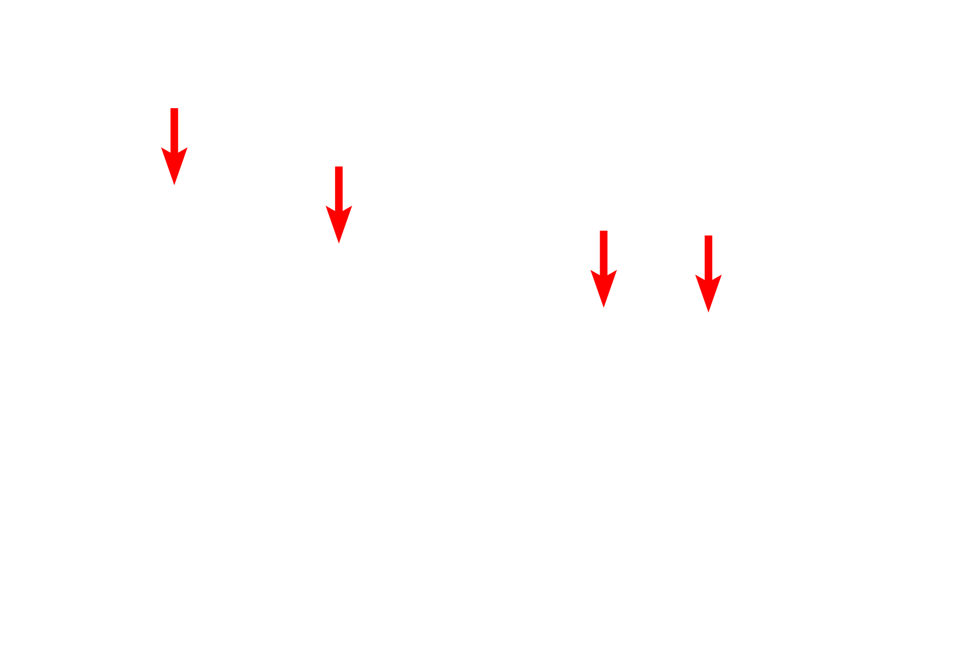  - Fenestrations in endothelium <p>The principal component of the filtration barrier of the glomerulus is the composite basal laminae of the endothelium and the podocyte.  The fenestrated endothelium of the glomerular capillaries lack the typical diaphragms.  Between alternating pedicels are filtration slits, that are spanned by a membrane that also regulates filtration.  30,000x</p>
