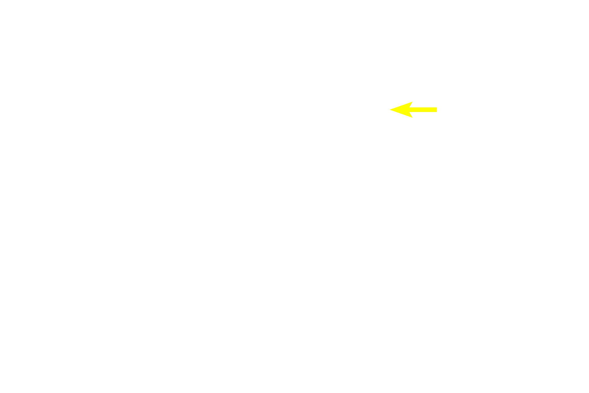 Ascending thick limb <p>The interlobular artery, a branch from the arcuate artery, gives rise to afferent arterioles, one of which supplies each glomerulus of a renal corpuscle.  Renal corpuscles are located in the convoluted portions of the cortex, which form the lateral boundaries of each renal lobule.  An interlobular artery and vein mark the lateral boundary of a lobule.  10x, 200x</p>
