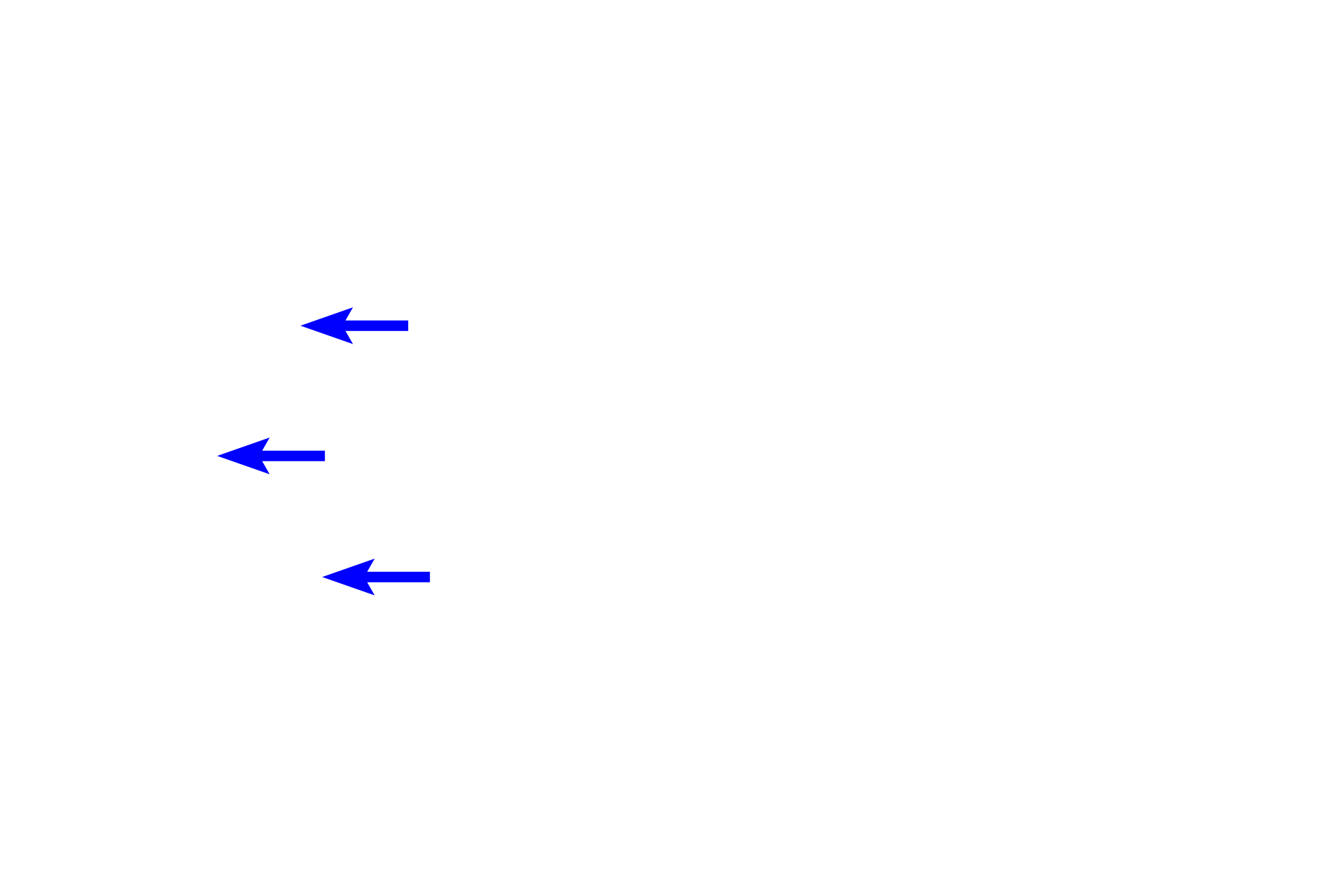 Proximal convoluted tubule <p>The interlobular artery, a branch from the arcuate artery, gives rise to afferent arterioles, one of which supplies each glomerulus of a renal corpuscle.  Renal corpuscles are located in the convoluted portions of the cortex, which form the lateral boundaries of each renal lobule.  An interlobular artery and vein mark the lateral boundary of a lobule.  10x, 200x</p>
