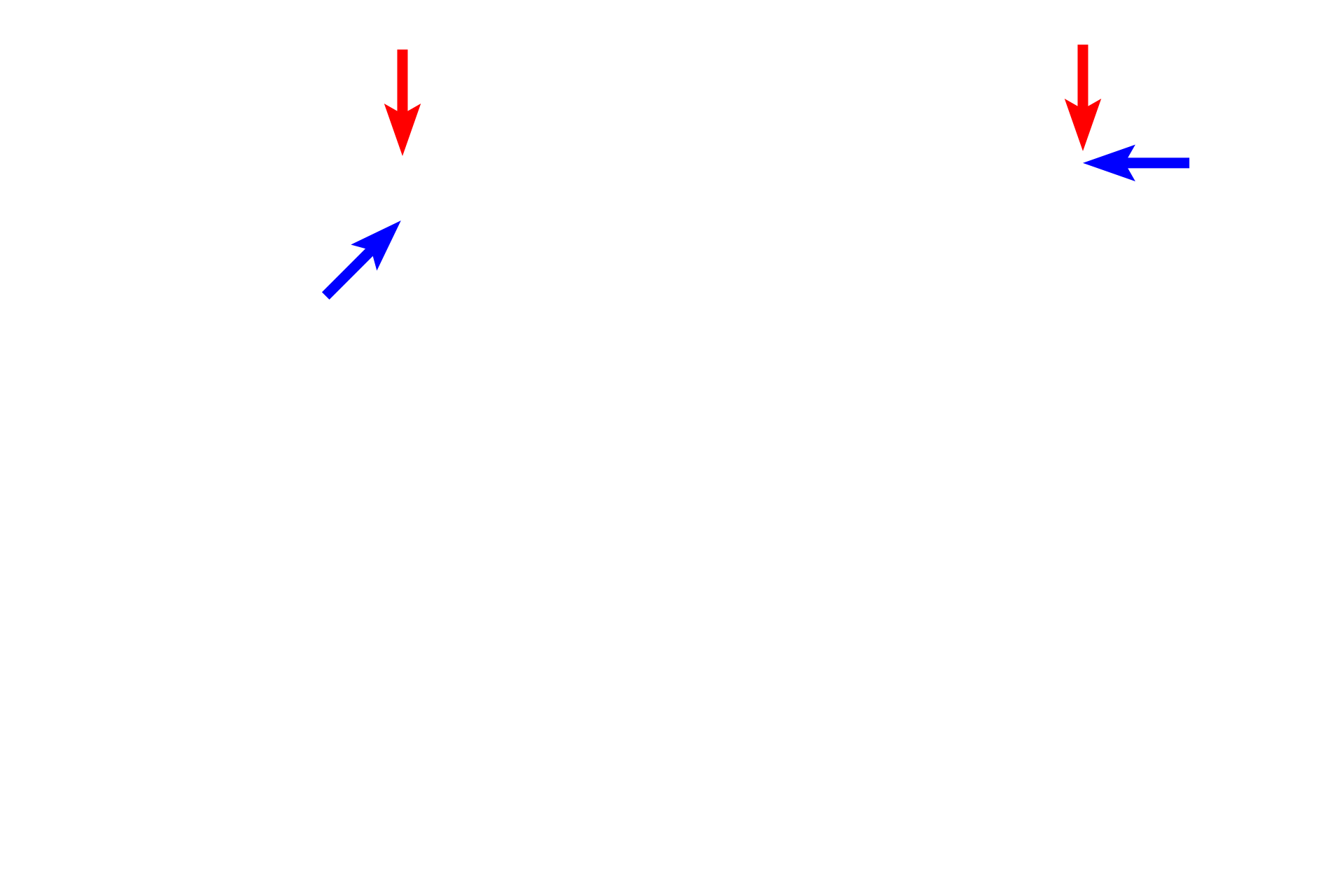 Renal corpuscle > <p>The renal corpuscle is composed of a tuft of capillaries called the glomerulus (blue arrows) which is surrounded by the double-walled Bowman’s capsule (red arrows).  The space of Bowman’s capsule receives the filtrate of blood.</p>
