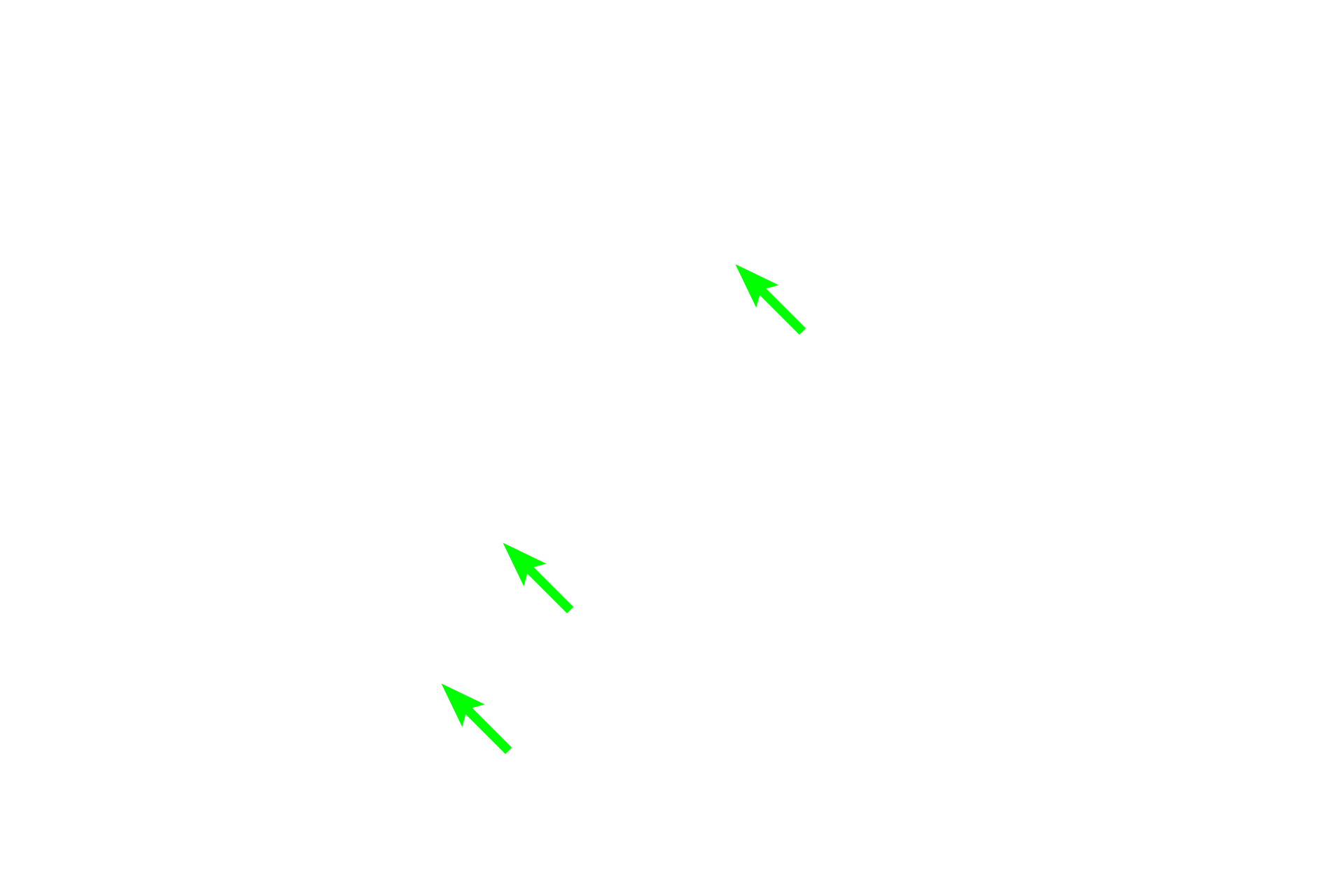  - Brush border <p>Proximal straight tubules have a tall cuboidal epithelium, regular arrangement of nuclei around the tubule and a brush border (obscured here by the luminal contents). Ascending thick tubules are lined by a lower cuboidal epithelium with irregularly spaced nuclei that frequently bulge into the lumen. Collecting tubules have columnar epithelia with conspicuous lateral cell boundaries</p>
