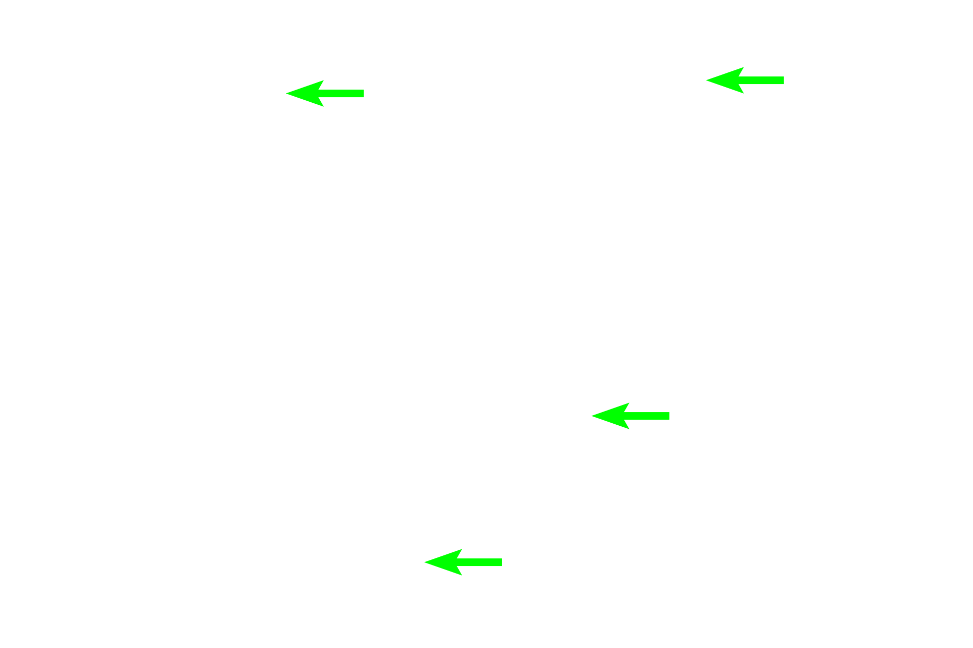 Ascending thick limbs <p>A cross section, rather than the usual longitudinal section, of the medulla demonstrates the thin limbs of the loop of Henle, the ascending thick limbs, medullary collecting ducts, and vasa recta.  Note the prominent lateral cell boundaries in the collecting ducts.  Proximal straight tubules do not extend this deeply into the medulla.  400x</p>
