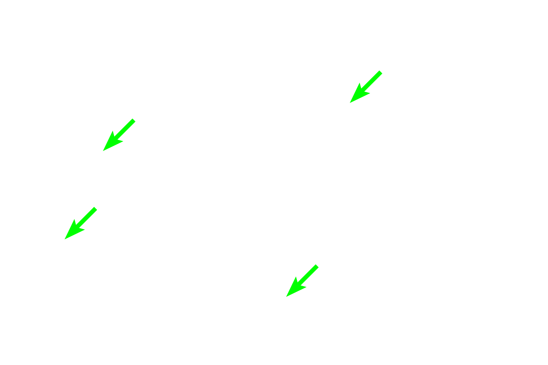 Thin limbs <p>A cross section, rather than the usual longitudinal section, of the medulla demonstrates the thin limbs of the loop of Henle, the ascending thick limbs, medullary collecting ducts, and vasa recta.  Note the prominent lateral cell boundaries in the collecting ducts.  Proximal straight tubules do not extend this deeply into the medulla.  400x</p>
