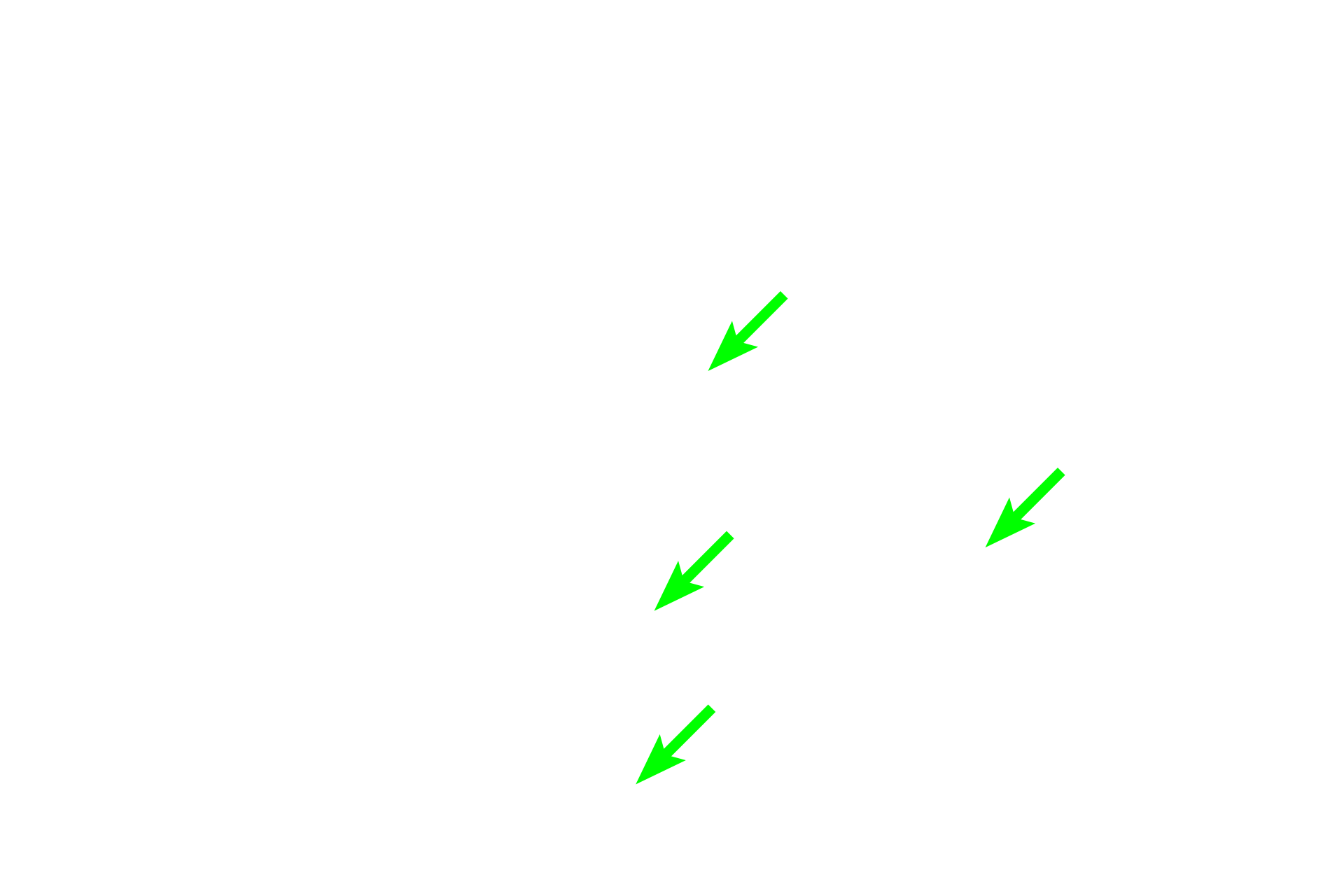 Vasa recta <p>A cross section, rather than the usual longitudinal section, of the medulla demonstrates the thin limbs of the loop of Henle, the ascending thick limbs, medullary collecting ducts, and vasa recta.  Note the prominent lateral cell boundaries in the collecting ducts.  Proximal straight tubules do not extend this deeply into the medulla.  400x</p>
