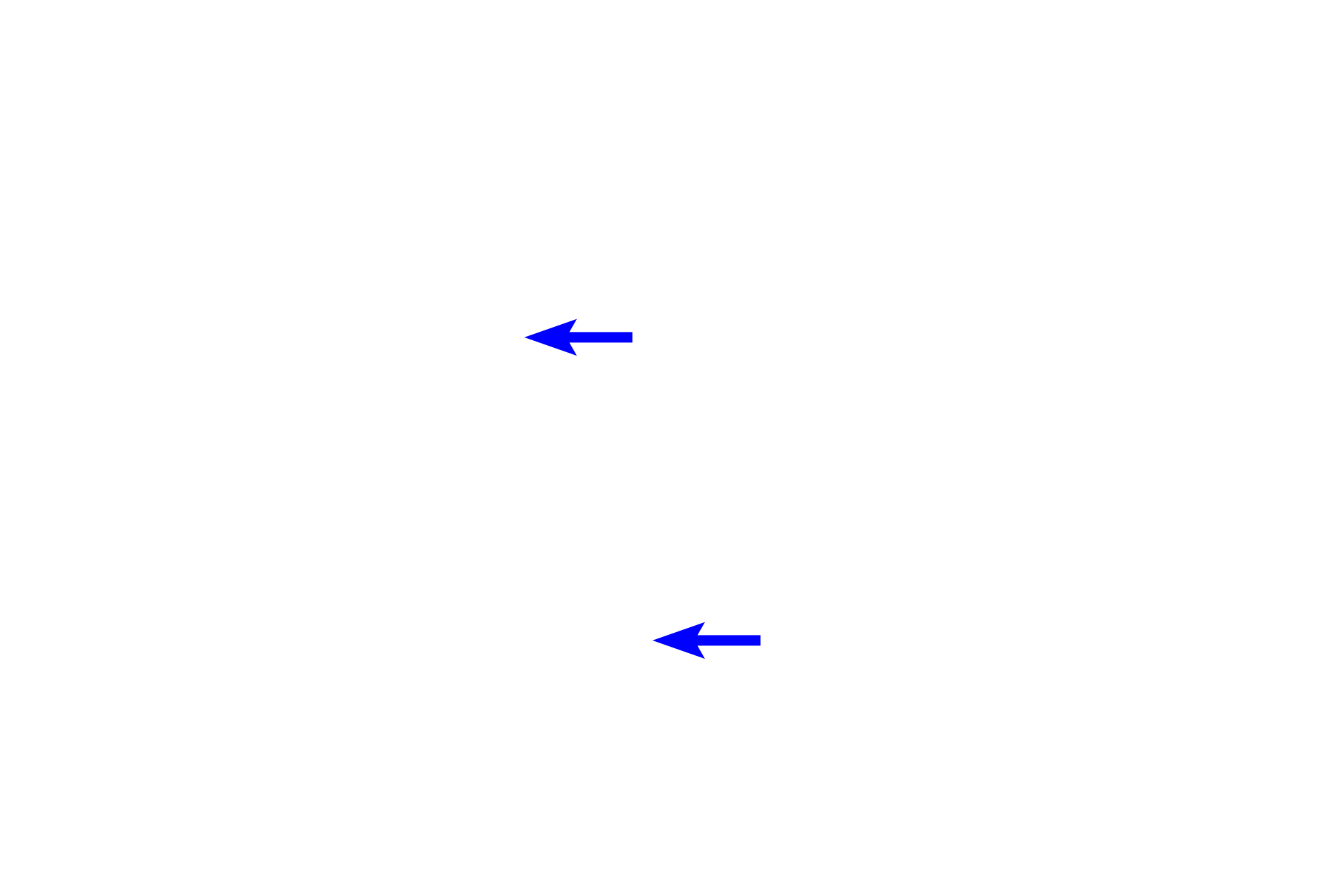  - Principle cells <p>The ascending thick tubule is lined with simple cuboidal epithelium whose nuclei are irregularly arranged around the lumen. The collecting duct is lined by simple columnar epithelial cells, called principle cells, with very pale cytoplasm and distinct lateral cell boundaries. Interspersed with these pale principle cells are darker intercalated cells, which often bulge into the lumen. 400x</p>
