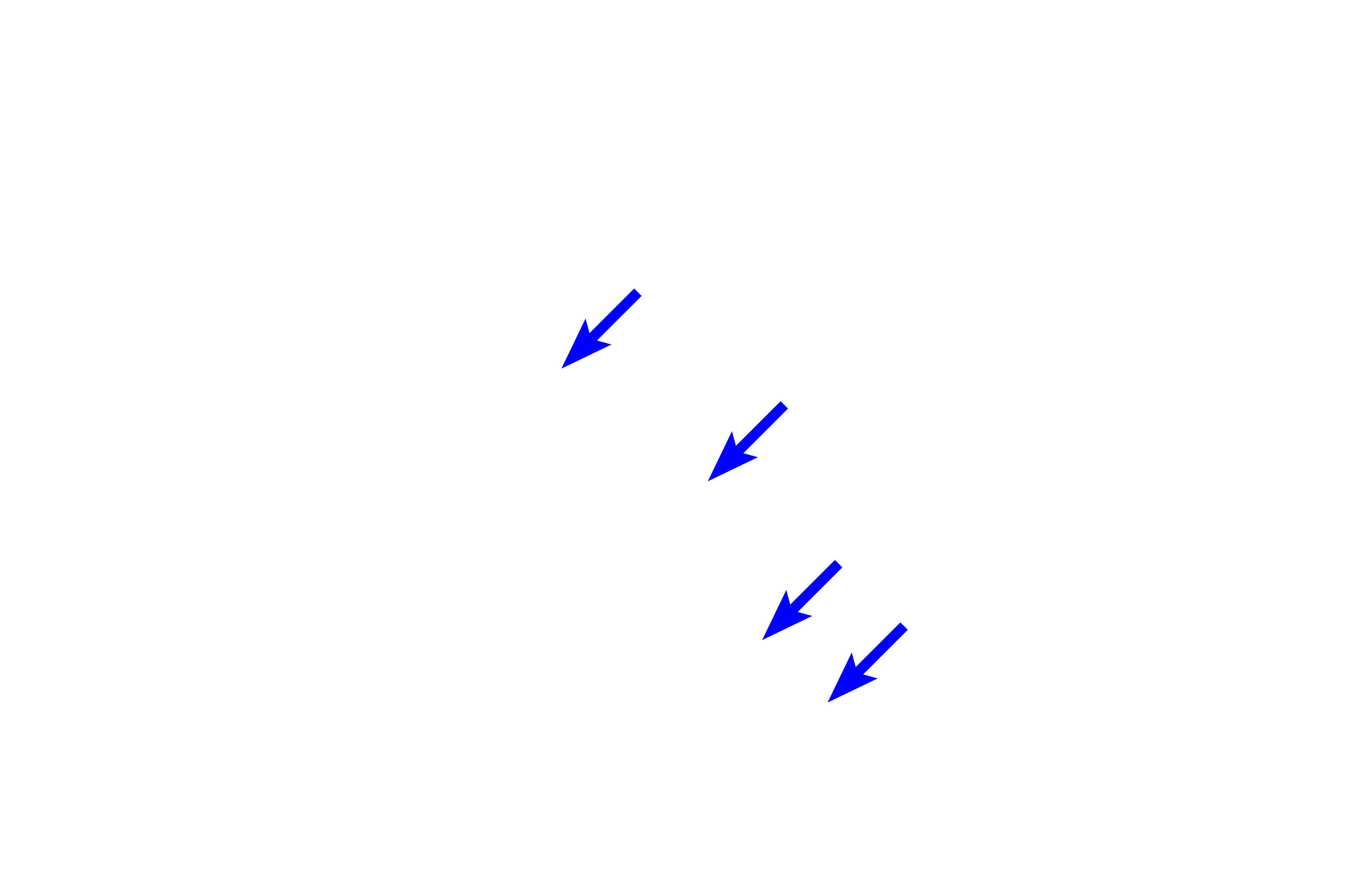  - Intercalated cells <p>The ascending thick tubule is lined with simple cuboidal epithelium whose nuclei are irregularly arranged around the lumen. The collecting duct is lined by simple columnar epithelial cells, called principle cells, with very pale cytoplasm and distinct lateral cell boundaries. Interspersed with these pale principle cells are darker intercalated cells, which often bulge into the lumen. 400x</p>
