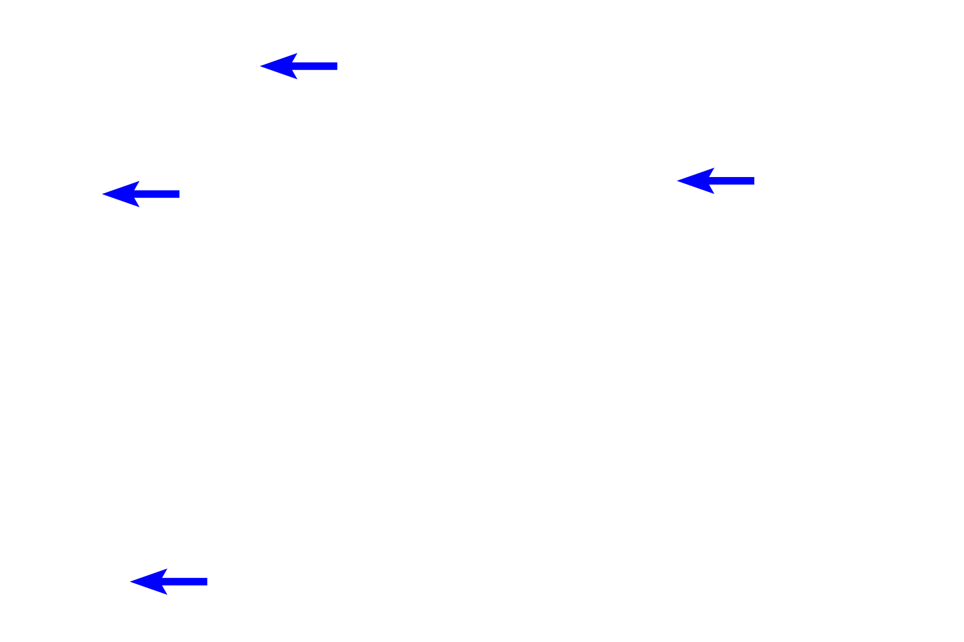 Thin limbs > <p>Thin limbs are lined by a simple squamous epithelium with nuclei that bulge into the lumen.  The vasa recta comprise a complex system of capillaries that run parallel to the tubules and represent the vascular component of the countercurrent exchange system that regulates the concentration of the urine.</p>
