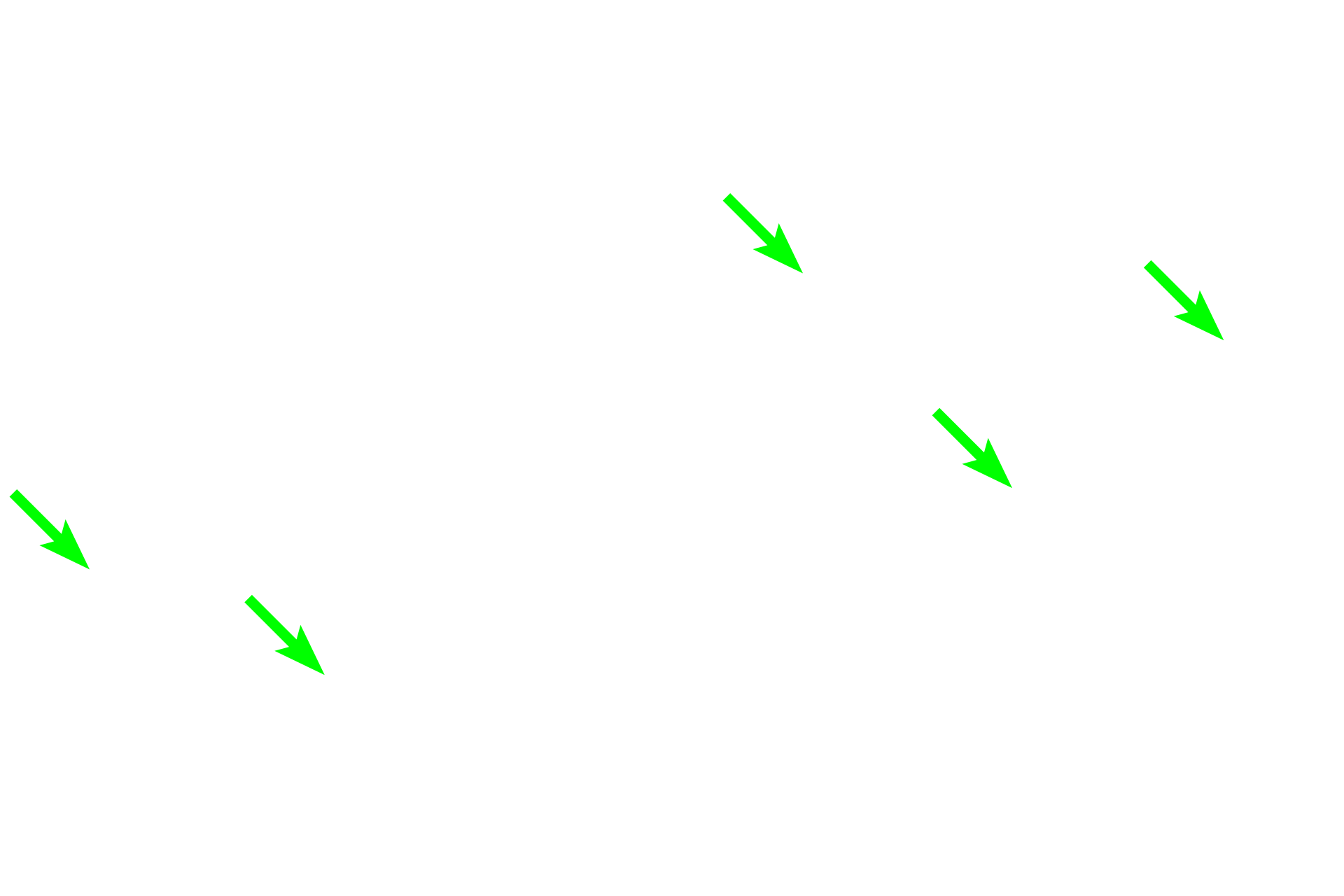 Vasa recta <p>Thin limbs are lined by a simple squamous epithelium with nuclei that bulge into the lumen.  The vasa recta comprise a complex system of capillaries that run parallel to the tubules and represent the vascular component of the countercurrent exchange system that regulates the concentration of the urine.</p>

