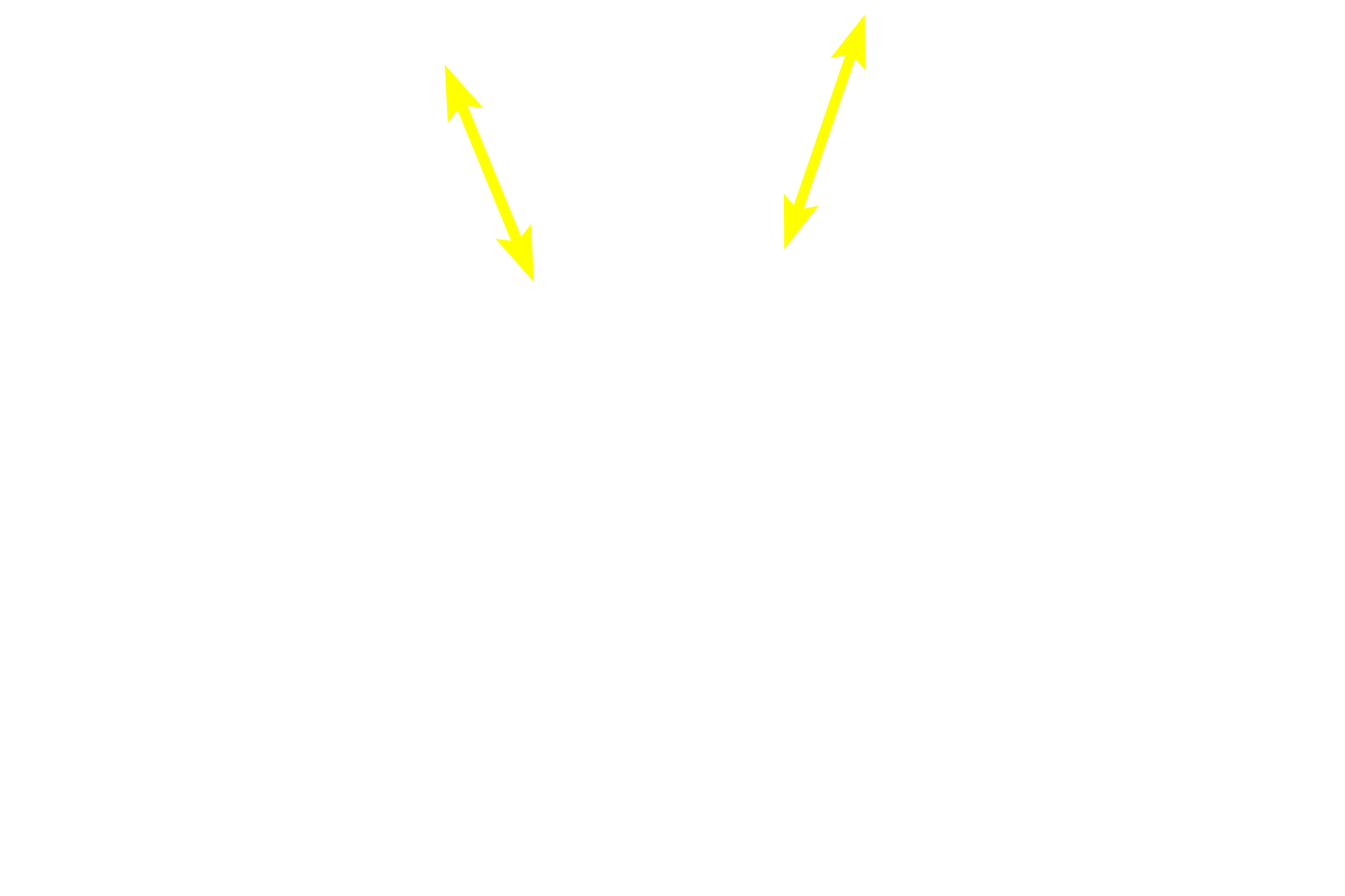 Cortex > <p>The cortex consists of convoluted regions (renal corpuscles, convoluted regions of proximal and distal tubules, and connecting tubules) and medullary rays (straight portions of proximal and distal tubules and cortical collecting ducts). The cortex is divided into cortical renal lobules, each of which has a medullary ray at its center and interlobular arteries in the convoluted portion at its perimeter.</p>
