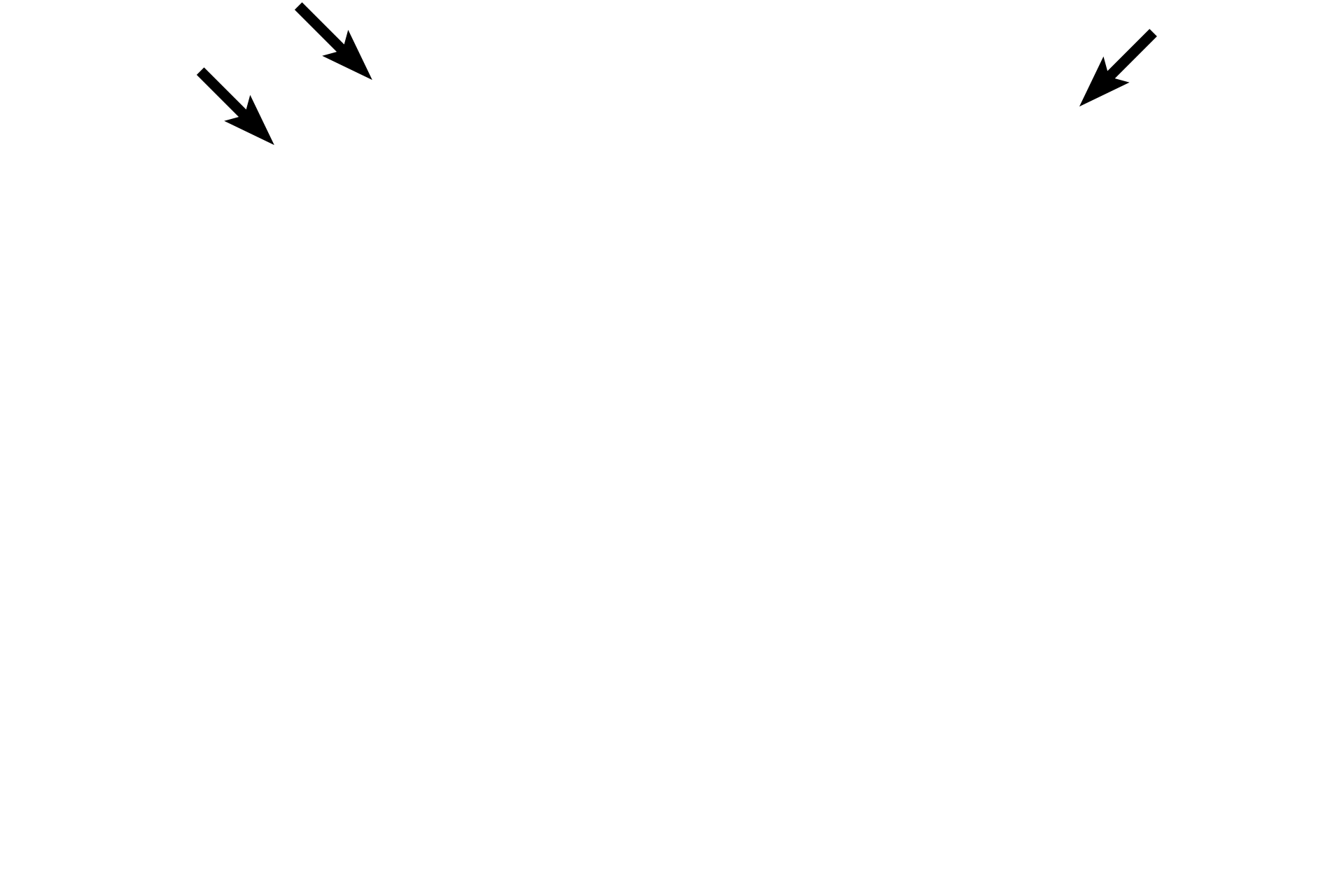 Capsule > <p>The kidney is covered by a connective tissue capsule which passes inward at the hilum and becomes continuous with the connective tissue forming the walls of the calyces.</p>

