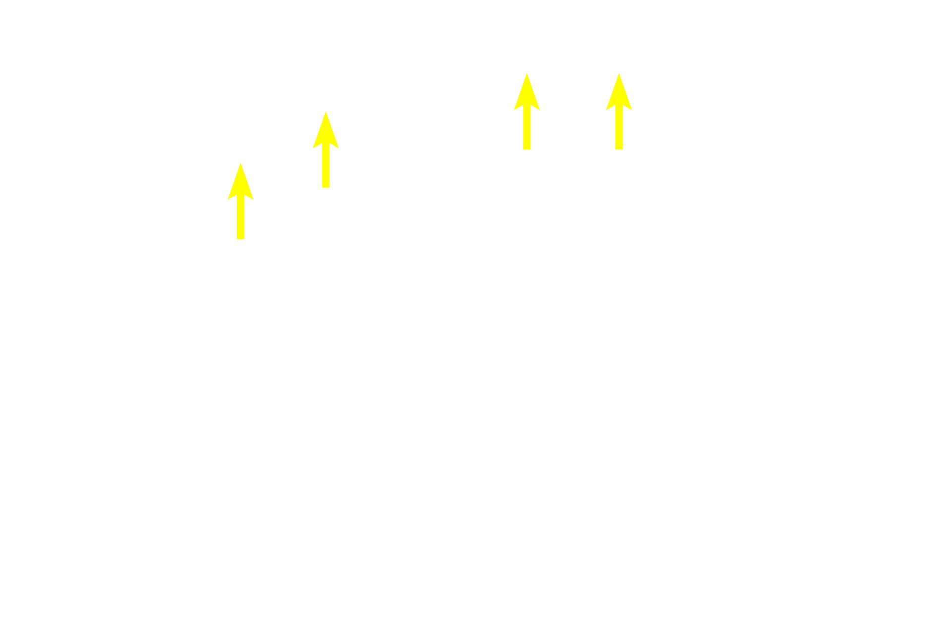  - Convoluted portions <p>The cortex consists of convoluted regions (renal corpuscles, convoluted regions of proximal and distal tubules, and connecting tubules) and medullary rays (straight portions of proximal and distal tubules and cortical collecting ducts). The cortex is divided into cortical renal lobules, each of which has a medullary ray at its center and interlobular arteries in the convoluted portion at its perimeter.</p>
