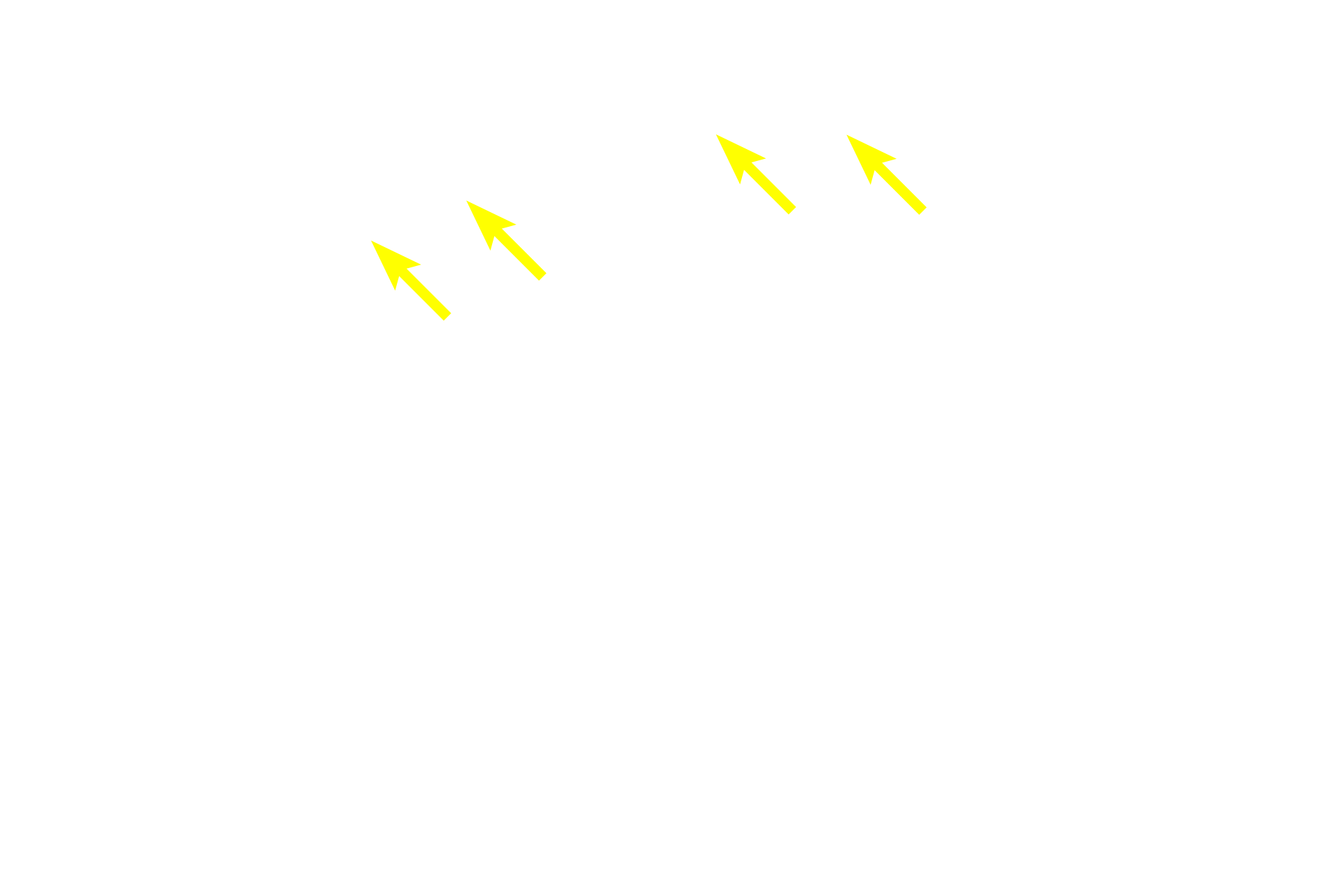  - Medullary rays <p>The cortex consists of convoluted regions (renal corpuscles, convoluted regions of proximal and distal tubules, and connecting tubules) and medullary rays (straight portions of proximal and distal tubules and cortical collecting ducts). The cortex is divided into cortical renal lobules, each of which has a medullary ray at its center and interlobular arteries in the convoluted portion at its perimeter.</p>
