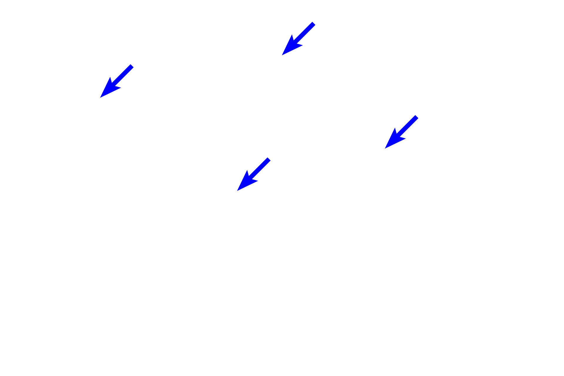 Vasa recta <p>The apex of the pyramid projects into the minor calyx as the renal papilla.  The openings of the papillary ducts of Bellini empty into the lumen of the minor calyx, forming the area cribrosa.  The minor calyx is lined by a transitional epithelium, which may be modified as it is reflected over the surface of the papilla.  200x</p>
