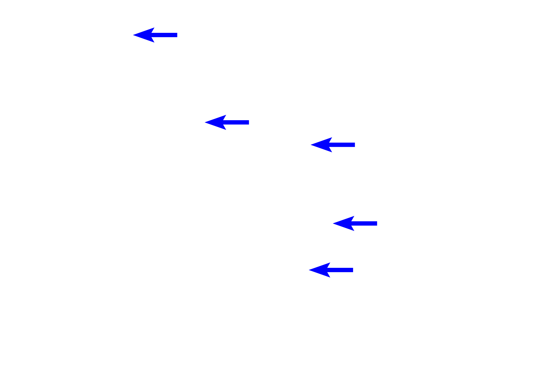 Papillary ducts of Bellini <p>The apex of the pyramid projects into the minor calyx as the renal papilla.  The openings of the papillary ducts of Bellini empty into the lumen of the minor calyx, forming the area cribrosa.  The minor calyx is lined by a transitional epithelium, which may be modified as it is reflected over the surface of the papilla.  200x</p>
