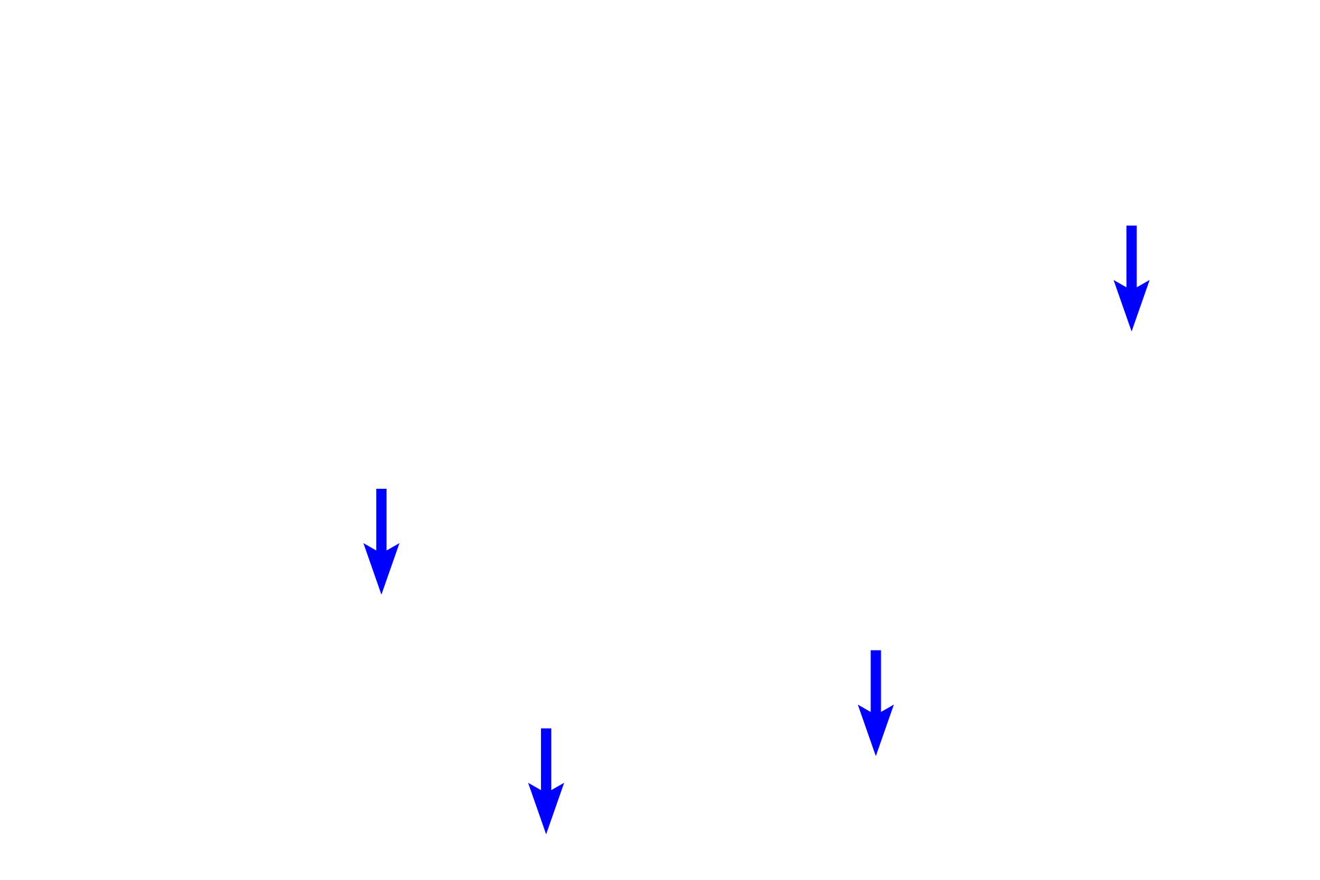  - Transitional epithelium <p>The apex of the pyramid projects into the minor calyx as the renal papilla.  The openings of the papillary ducts of Bellini empty into the lumen of the minor calyx, forming the area cribrosa.  The minor calyx is lined by a transitional epithelium, which may be modified as it is reflected over the surface of the papilla.  200x</p>
