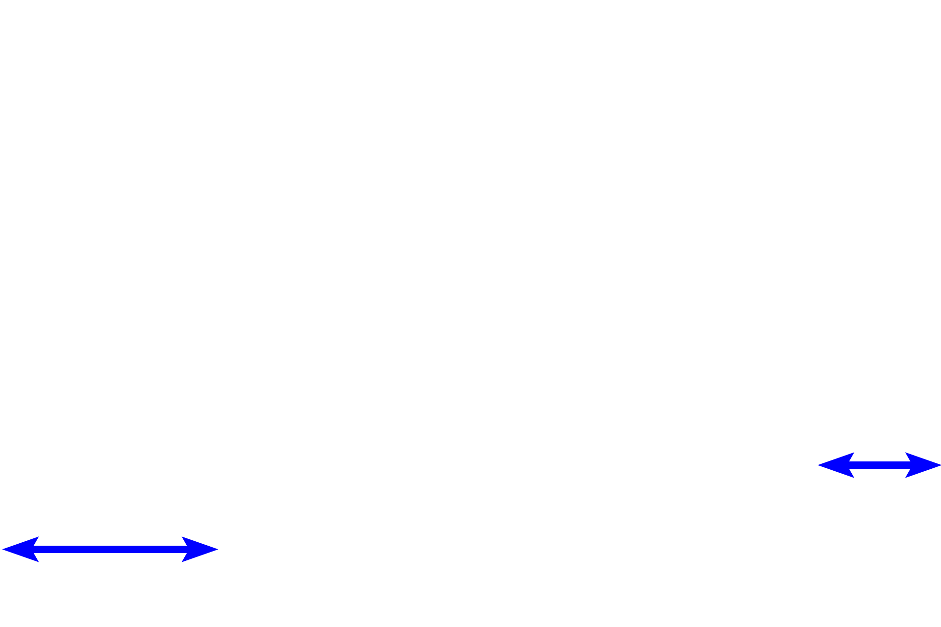Renal sinus <p>The apex of the pyramid projects into the minor calyx as the renal papilla.  The openings of the papillary ducts of Bellini empty into the lumen of the minor calyx, forming the area cribrosa.  The minor calyx is lined by a transitional epithelium, which may be modified as it is reflected over the surface of the papilla.  200x</p>
