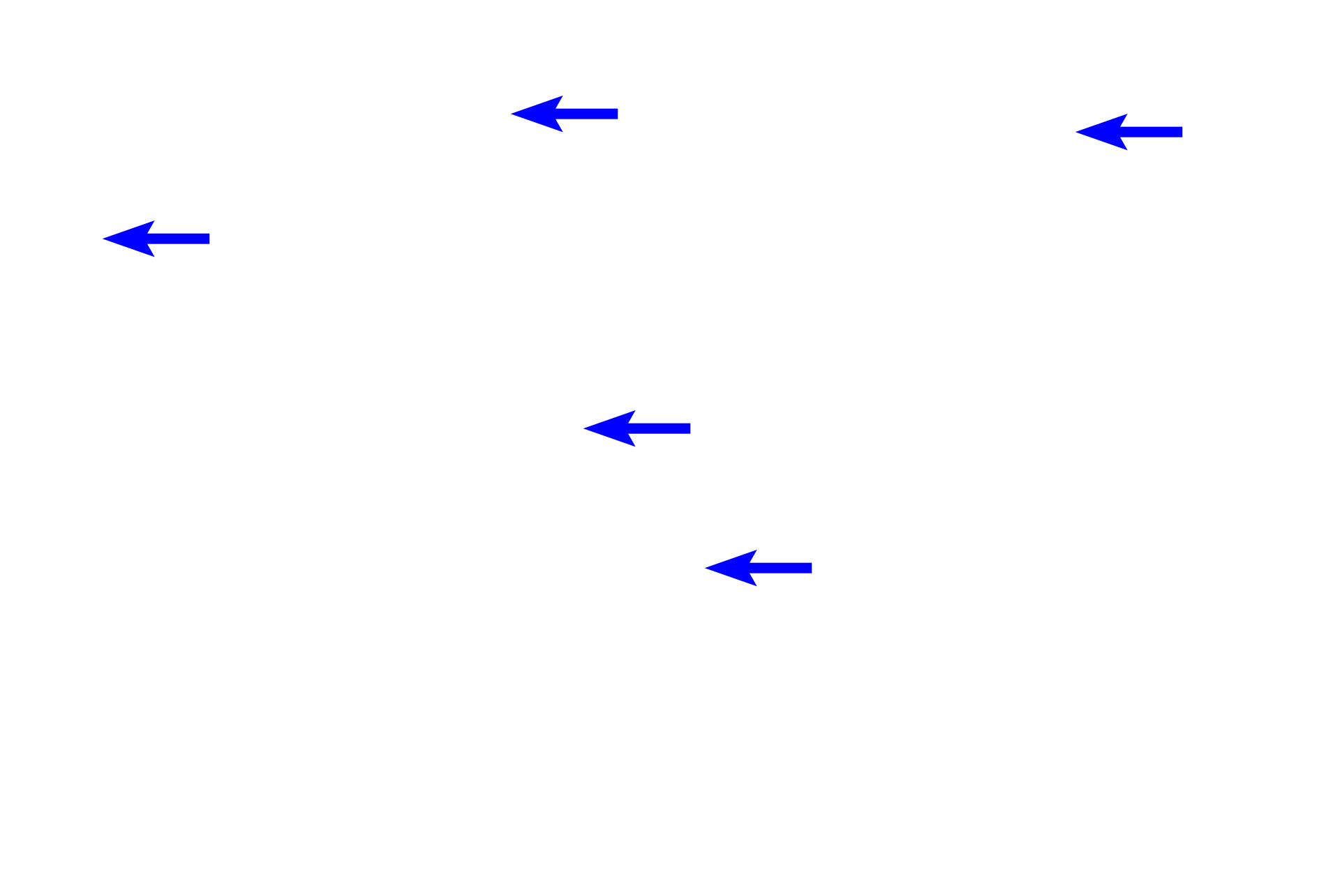  - Papillary ducts <p>Papillary ducts of Bellini discharge urine into the lumen of a minor calyx, forming a perforated region of the papilla called the area cribrosa.  The minor calyx is continuous with a major calyx, which continues into the renal pelvis.  In general, these excretory passages are lined by transitional epithelium resting on a thin lamina propria and a double layer of smooth muscle.  200x</p>
