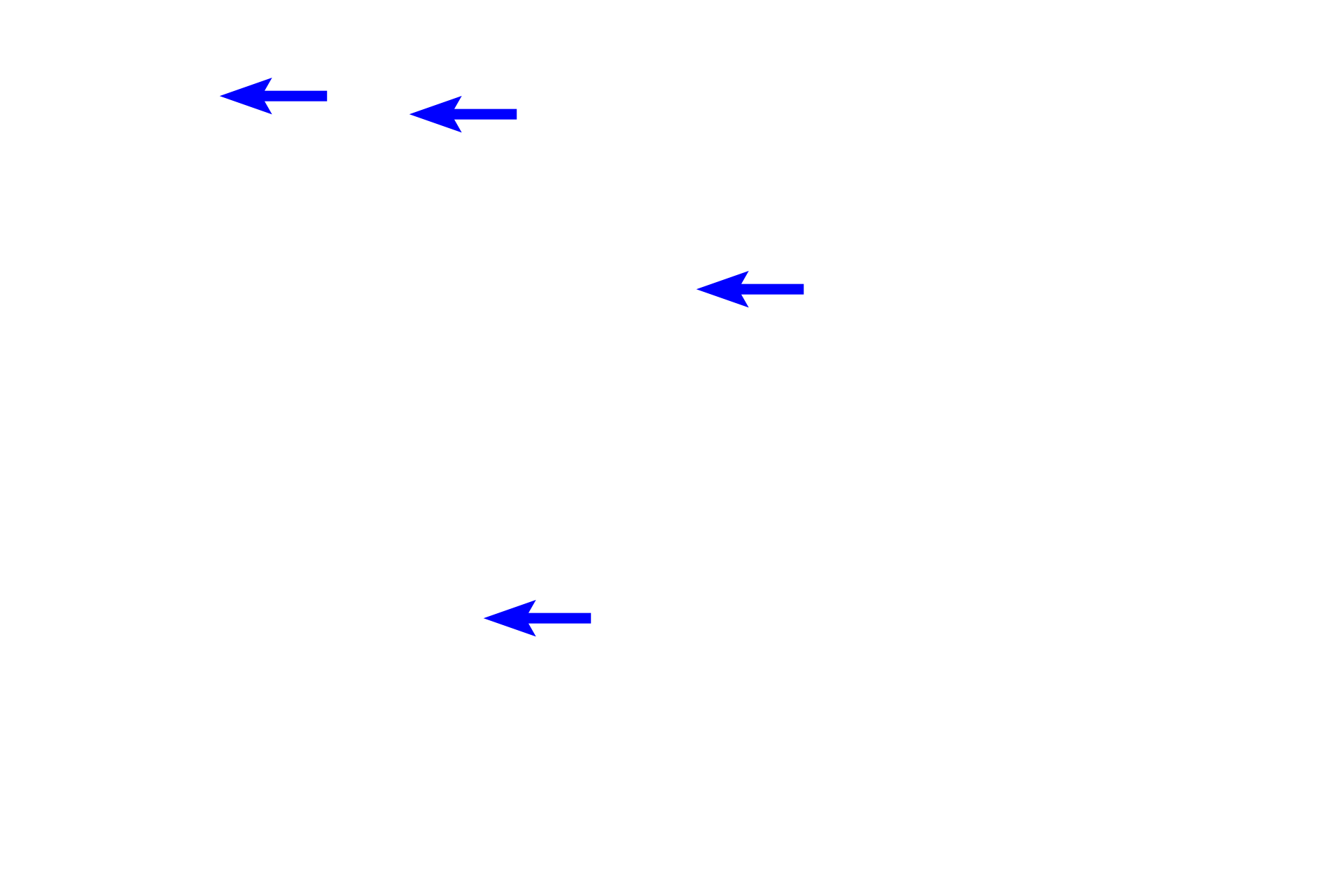  - Vasa recta <p>Papillary ducts of Bellini discharge urine into the lumen of a minor calyx, forming a perforated region of the papilla called the area cribrosa.  The minor calyx is continuous with a major calyx, which continues into the renal pelvis.  In general, these excretory passages are lined by transitional epithelium resting on a thin lamina propria and a double layer of smooth muscle.  200x</p>
