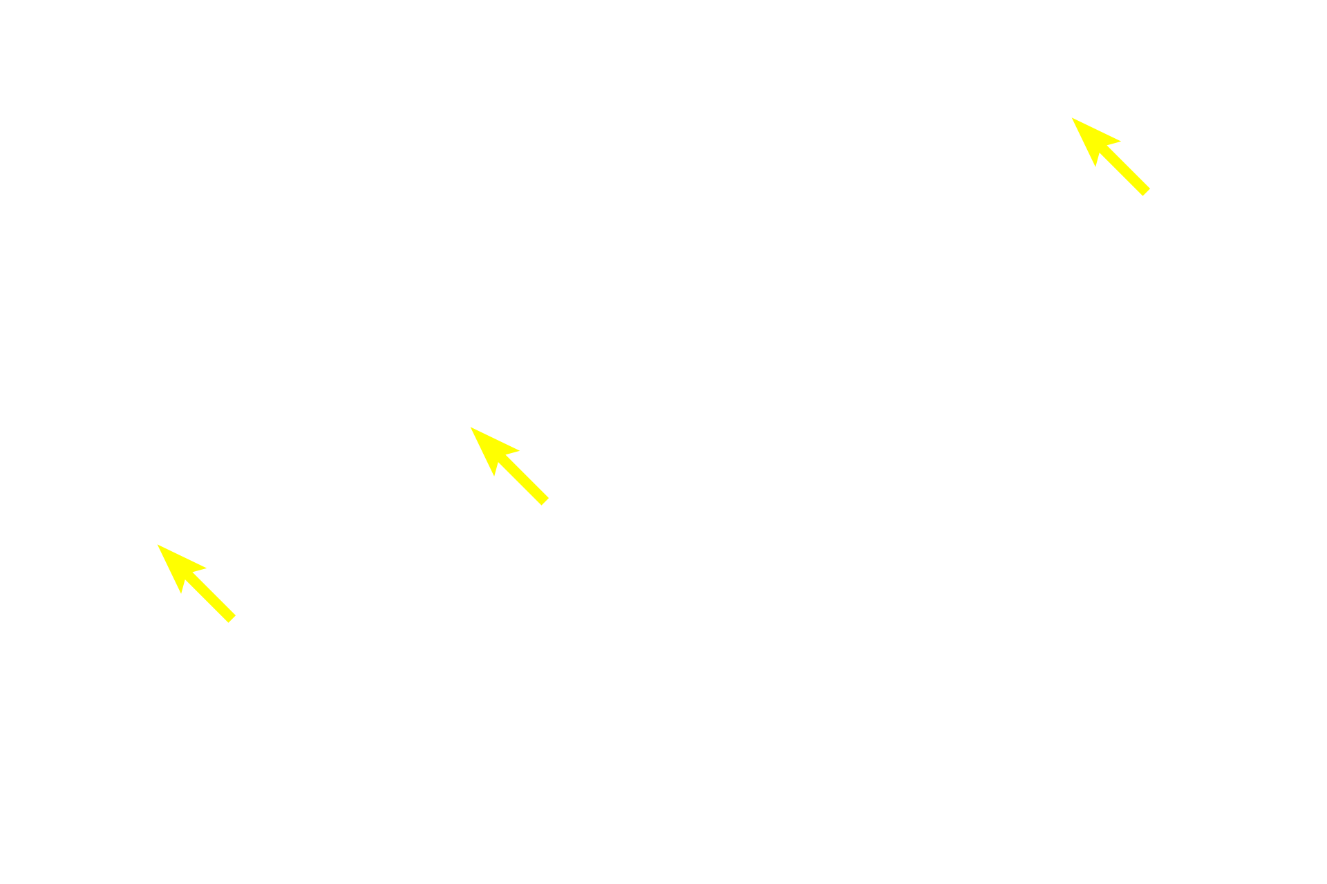  - Lamina propria <p>The mucosa of the minor calyx consists of a transitional epithelium resting on a thin lamina propria and two layers of smooth muscle oriented perpendicularly to each other.  Beyond the calyx is the renal sinus which contains adipose tissue.  800x</p>
