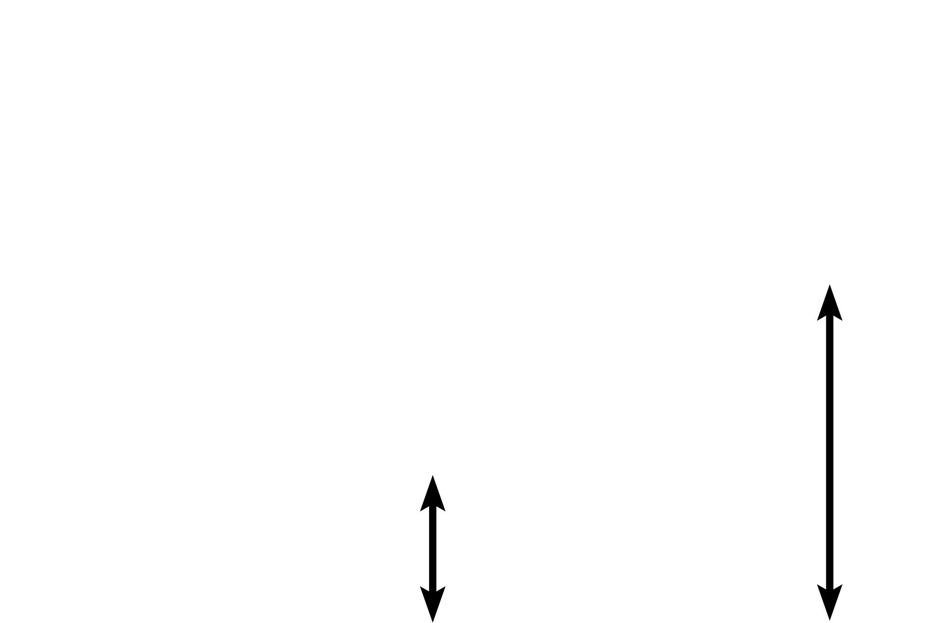Renal sinus <p>The mucosa of the minor calyx consists of a transitional epithelium resting on a thin lamina propria and two layers of smooth muscle oriented perpendicularly to each other.  Beyond the calyx is the renal sinus which contains adipose tissue.  800x</p>
