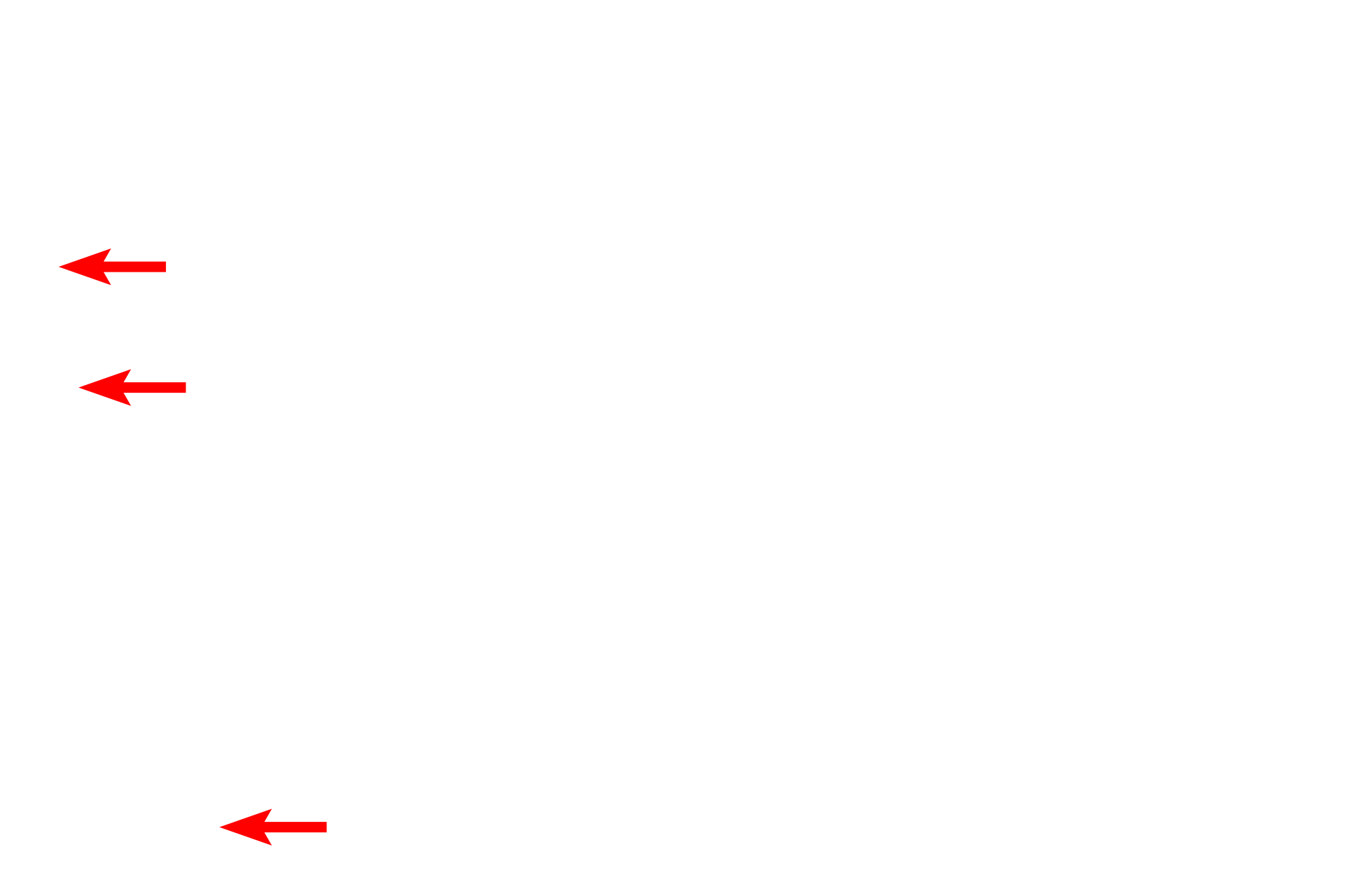 Basal membrane infoldings <p>The epithelial wall of a proximal tubule displays a brush border on the luminal surface and infoldings of the basal plasma membrane on the basal surface.  Tubular invaginations of the clefts between microvilli (apical canaliculi) extend into the cytoplasm.  These canaliculi and poor fixation of the numerous mitochondria result in the foamy appearance of the cells seen at the light microscopic level.  5000x</p>
