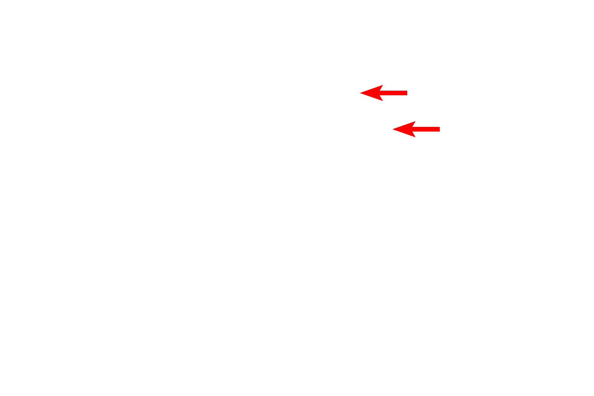 Lipid droplets <p>The epithelial wall of a proximal tubule displays a brush border on the luminal surface and infoldings of the basal plasma membrane on the basal surface.  Tubular invaginations of the clefts between microvilli (apical canaliculi) extend into the cytoplasm.  These canaliculi and poor fixation of the numerous mitochondria result in the foamy appearance of the cells seen at the light microscopic level.  5000x</p>
