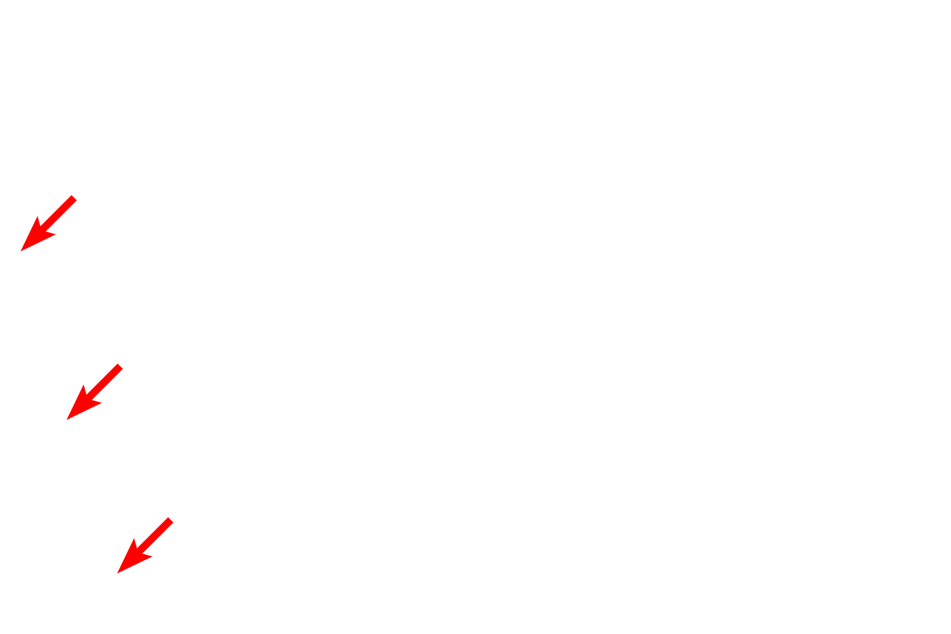 Basal lamina <p>The epithelial wall of a proximal tubule displays a brush border on the luminal surface and infoldings of the basal plasma membrane on the basal surface.  Tubular invaginations of the clefts between microvilli (apical canaliculi) extend into the cytoplasm.  These canaliculi and poor fixation of the numerous mitochondria result in the foamy appearance of the cells seen at the light microscopic level.  5000x</p>
