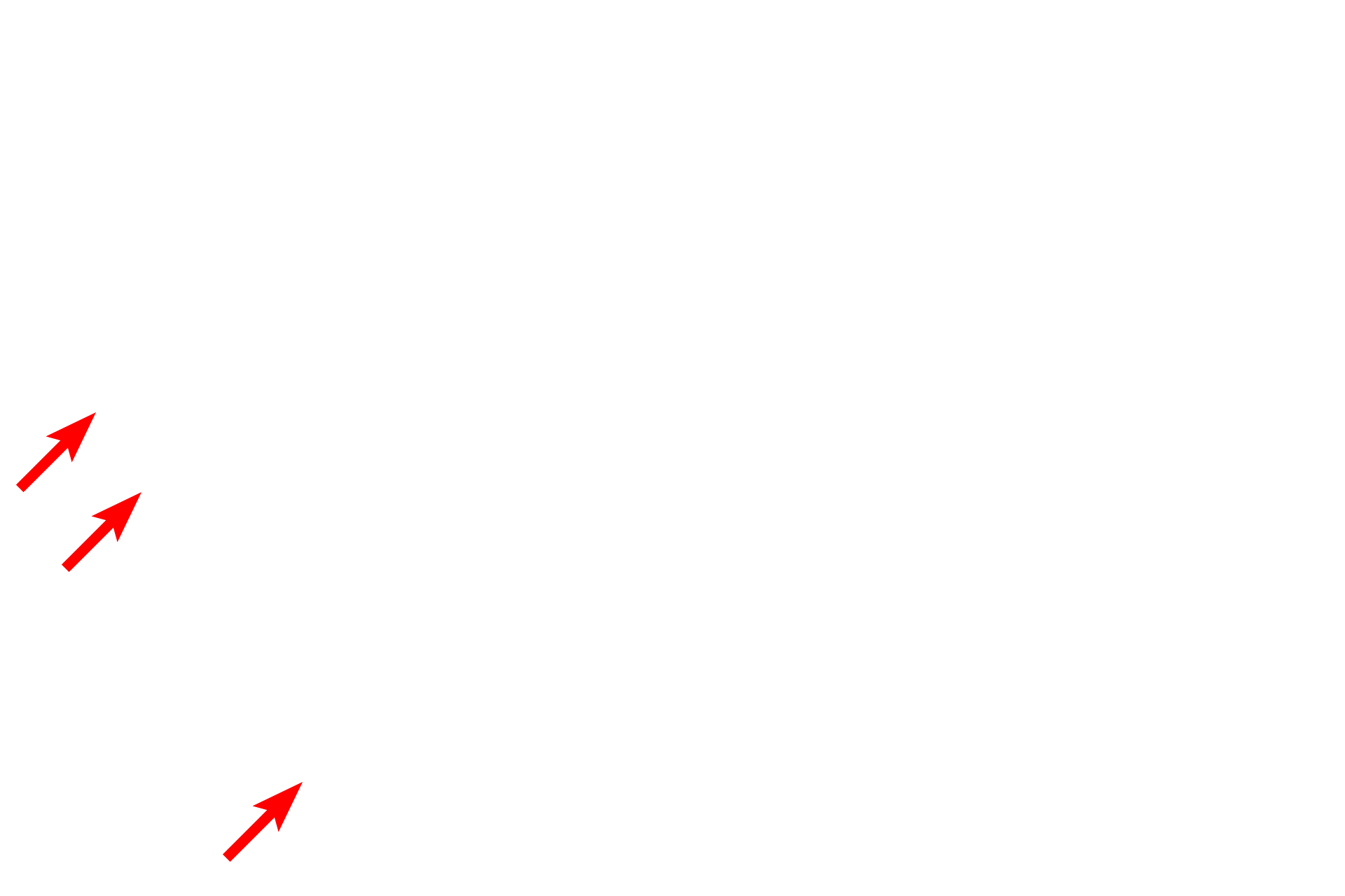  - Fenestrated endothelium <p>The basal region of this cell of a distal convoluted tubule lies adjacent to a fenestrated, peritubular capillary.  Note the numerous basilar infoldings of the plasma membrane of the cell and the longitudinally oriented mitochondria wedged between the folds.  15,000x</p>
