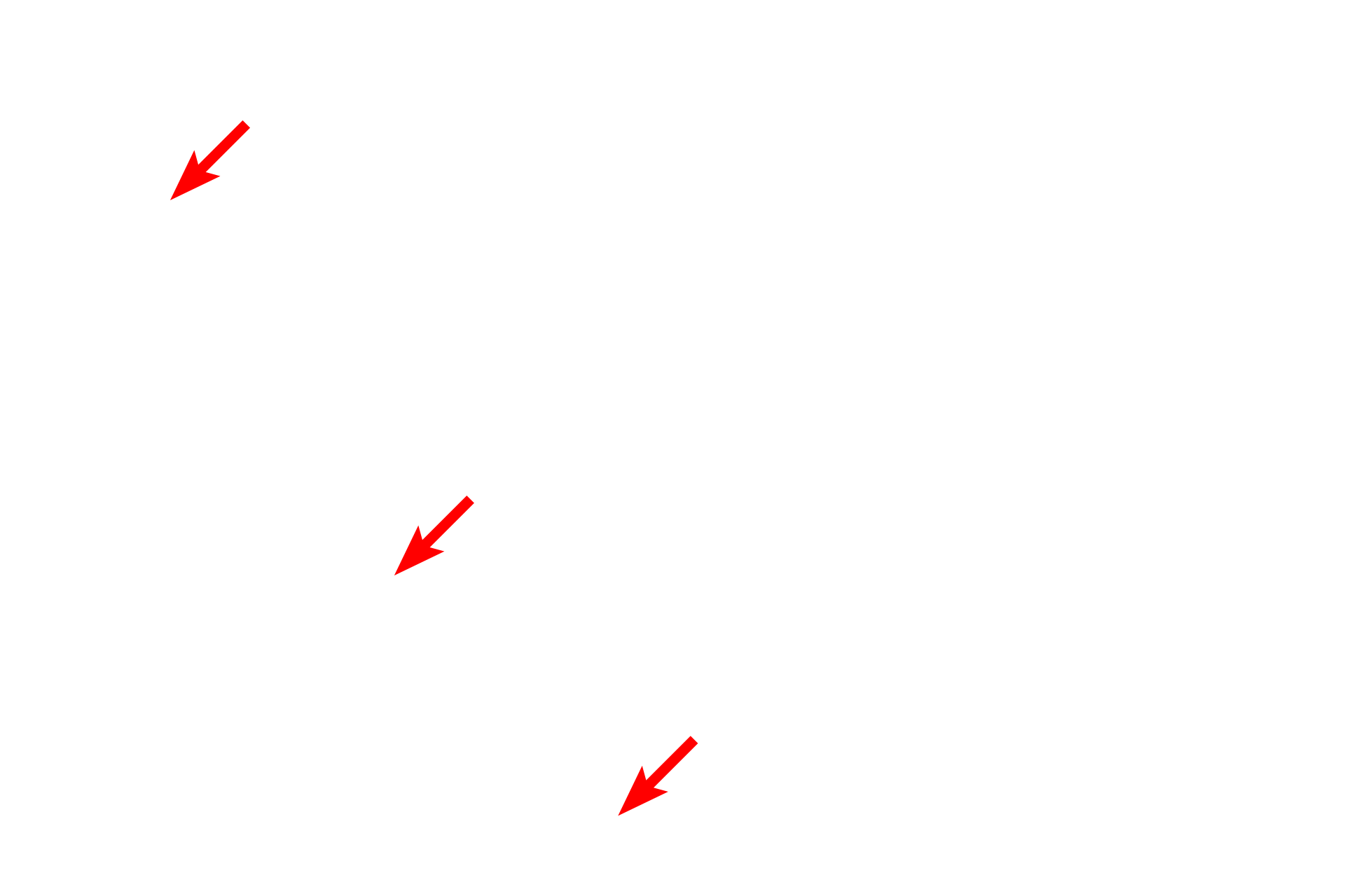 Basal lamina of tubule cell <p>The basal region of this cell of a distal convoluted tubule lies adjacent to a fenestrated, peritubular capillary.  Note the numerous basilar infoldings of the plasma membrane of the cell and the longitudinally oriented mitochondria wedged between the folds.  15,000x</p>
