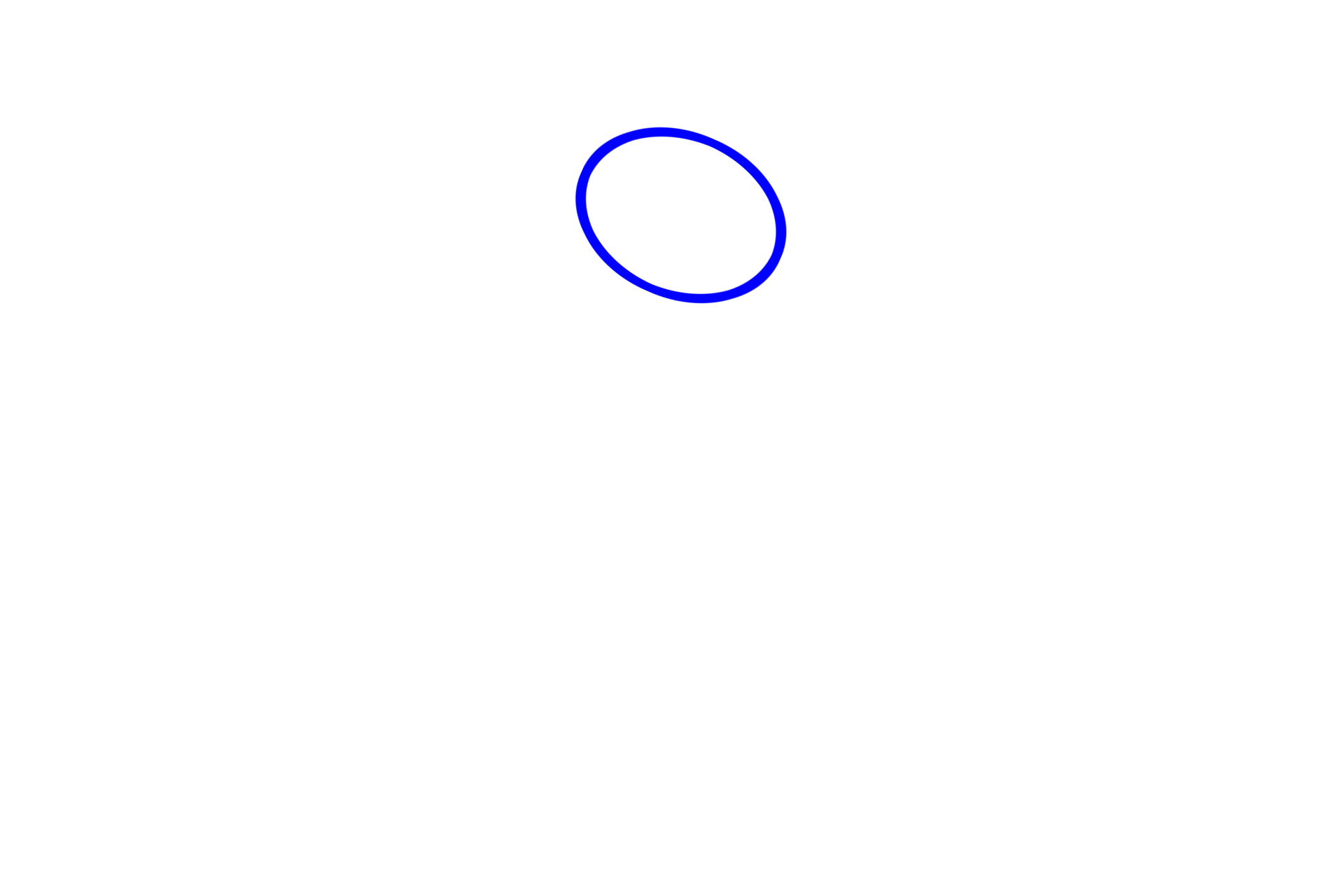 Juxtaglomerular apparatus > <p>The juxtaglomerular apparatus, located at the vascular pole of the renal corpuscle, is composed of the macula densa of the distal convoluted tubule and the juxtaglomerular cells of the afferent arteriole.  The macula densa, a region of tightly packed cells in the distal convoluted tubule, lies adjacent to the juxtaglomerular cells (modified smooth muscle) of the afferent arteriole.</p>

