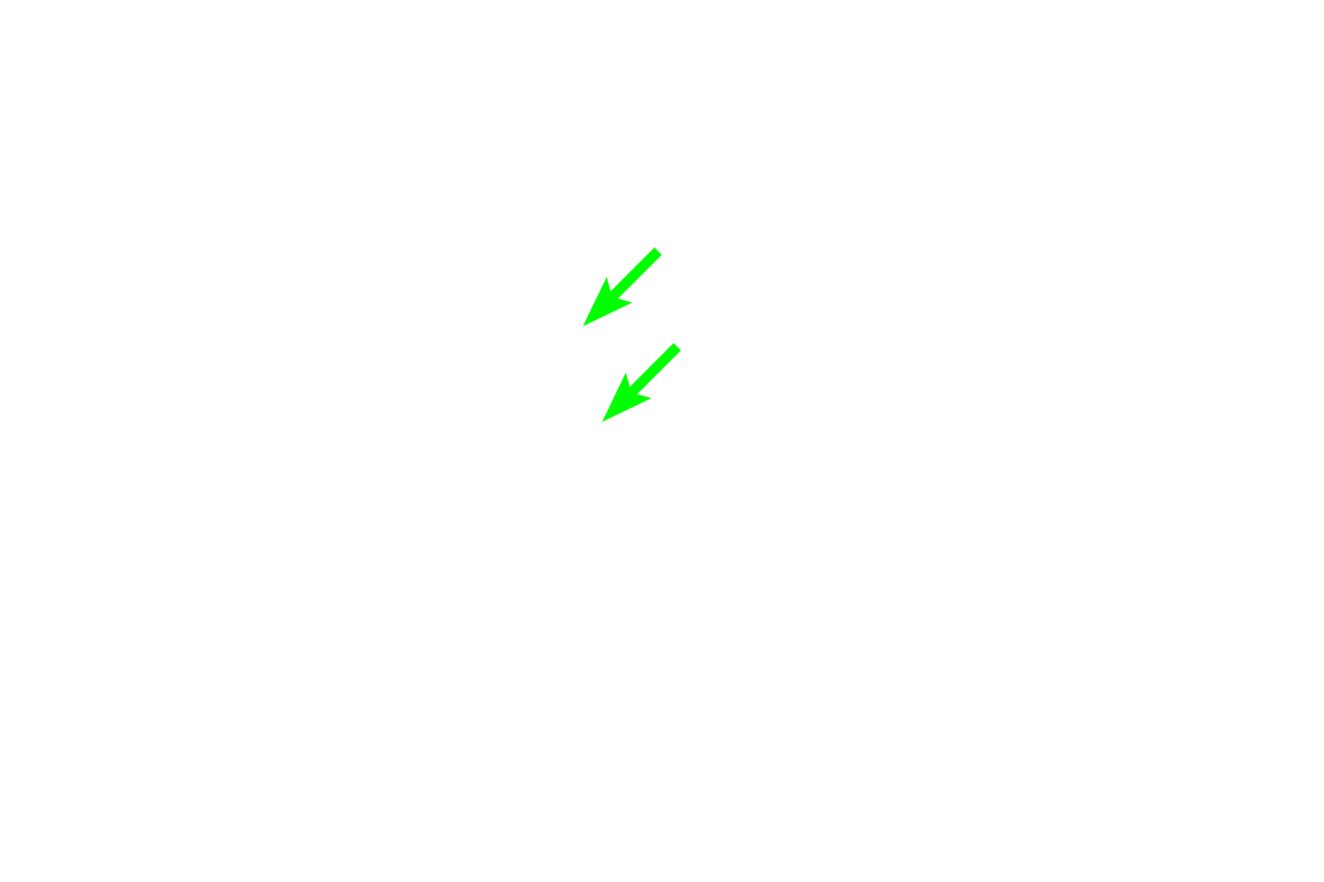  - Juxtaglomerular cells <p>The juxtaglomerular apparatus has two components.  Juxtaglomerular cells are modified smooth muscle cells in the wall of the afferent arteriole at the vascular pole of the renal corpuscle.  The macula densa, in the wall of the adjacent ascending thick limb (distal straight tubule), is composed of numerous, compacted cells.  The juxtaglomerular apparatus regulates blood pressure and volume.  1000x</p>
