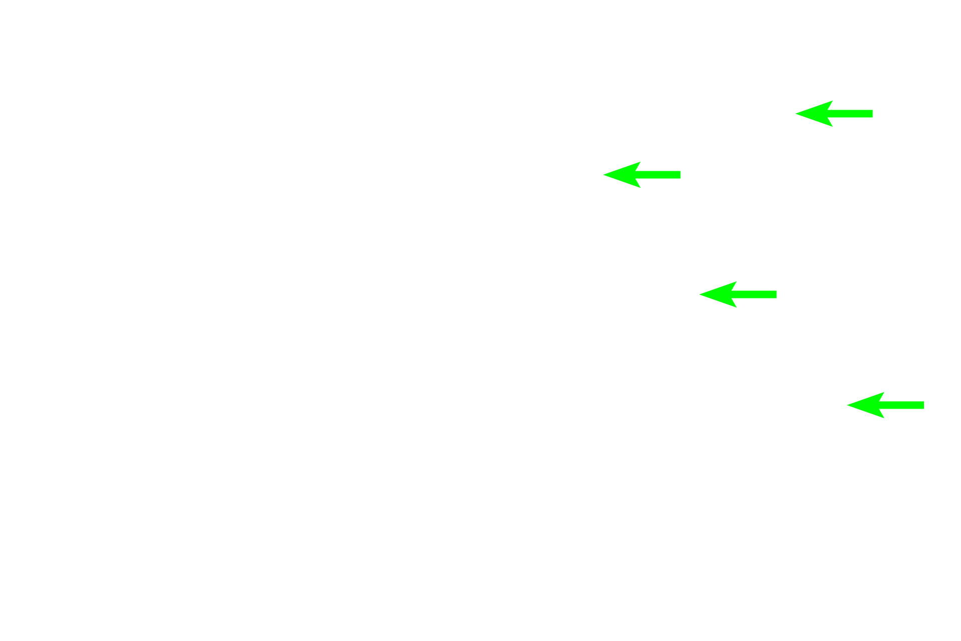  - Proximal straight tubules <p>Medullary rays separate convoluted portions of the cortex and form the core of a renal lobule. Straight portions of proximal tubules and thick ascending limbs (distal straight tubules) are located in the medullary rays and are similar in appearance to their respective convoluted portions.  Collecting ducts are also present in the medullary ray. 200x</p>

