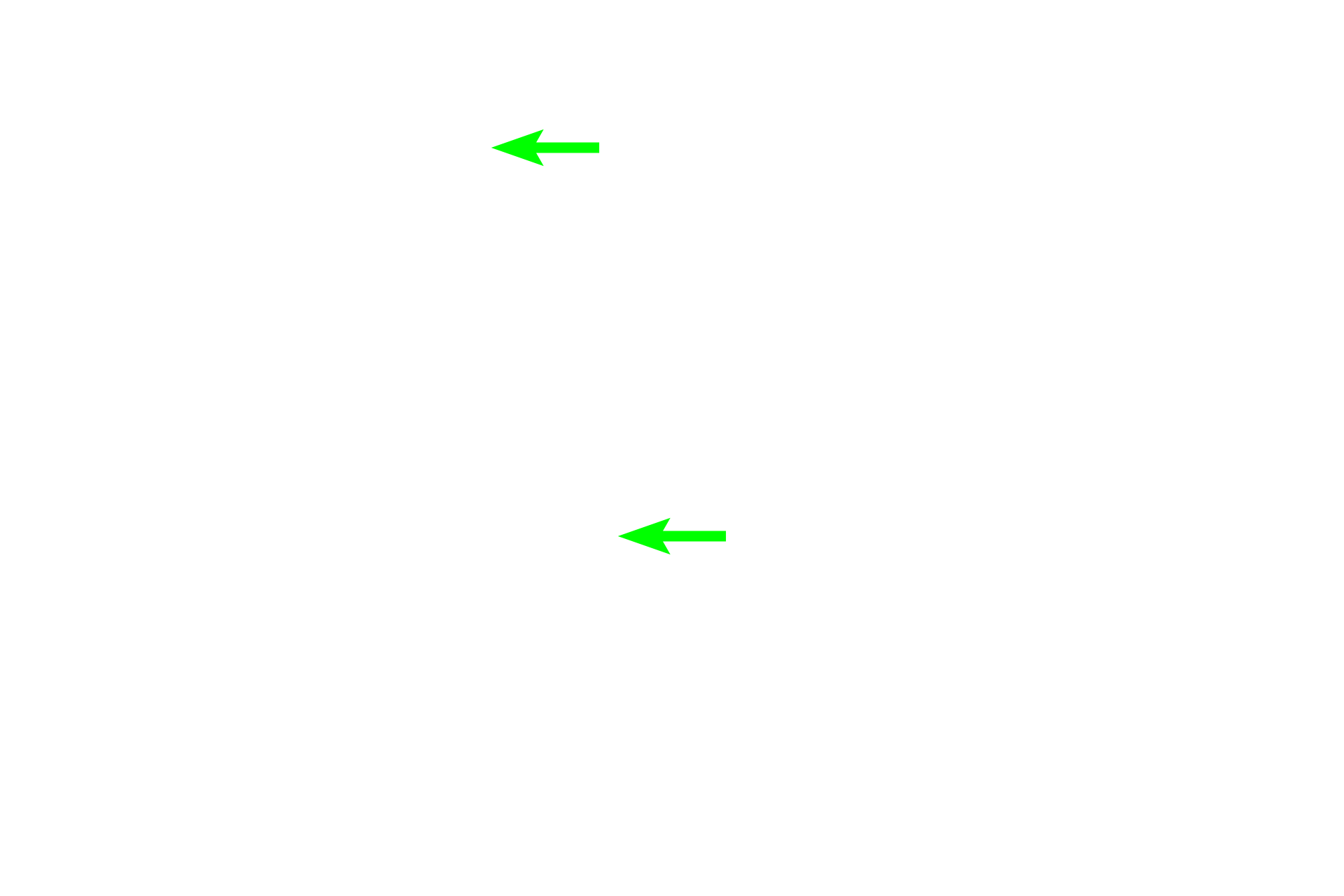  - Collecting ducts <p>Medullary rays separate convoluted portions of the cortex and form the core of a renal lobule. Straight portions of proximal tubules and thick ascending limbs (distal straight tubules) are located in the medullary rays and are similar in appearance to their respective convoluted portions.  Collecting ducts are also present in the medullary ray. 200x</p>
