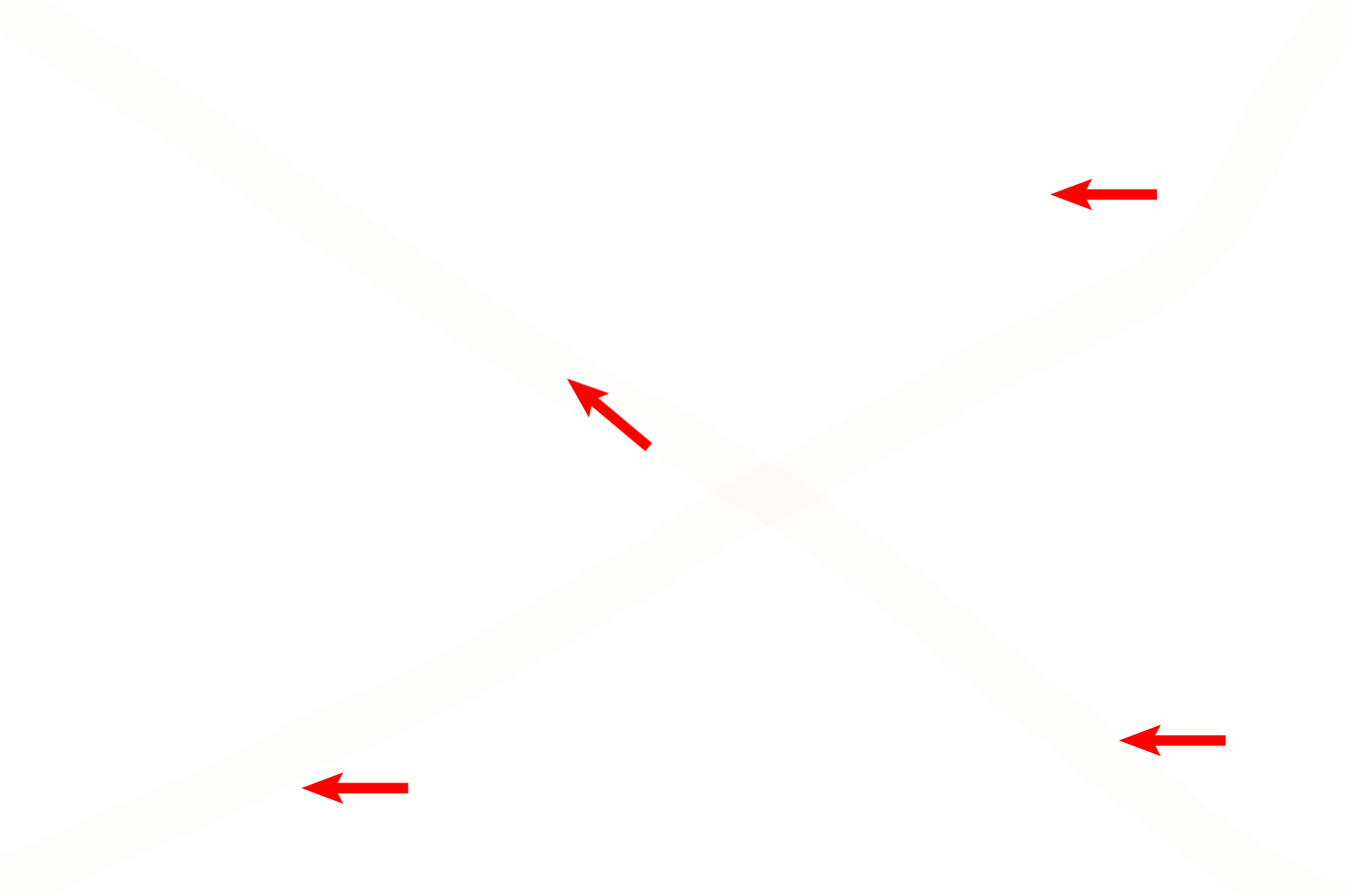  - Haversian canals <p>The concentric lamellae of osteons, cut in cross section here, can be more easily visualized in a ground bone preparation. Each osteon is a columnar-shaped structure whose long axis runs parallel to the long axis of the bone, thus providing great strength to a long bone. 200x</p>
