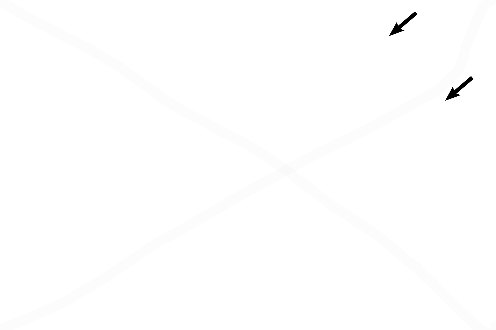 Endosteum <p>Intramembranous bone formation in the fetus can produce compact, as well as spongy bone, as seen in this image from the diaphysis of a fetal, long bone. The lack of lamellae, the blue tint to the matrix and the rounded, numerous osteocytes are all indicative of woven bone. 200x</p>
