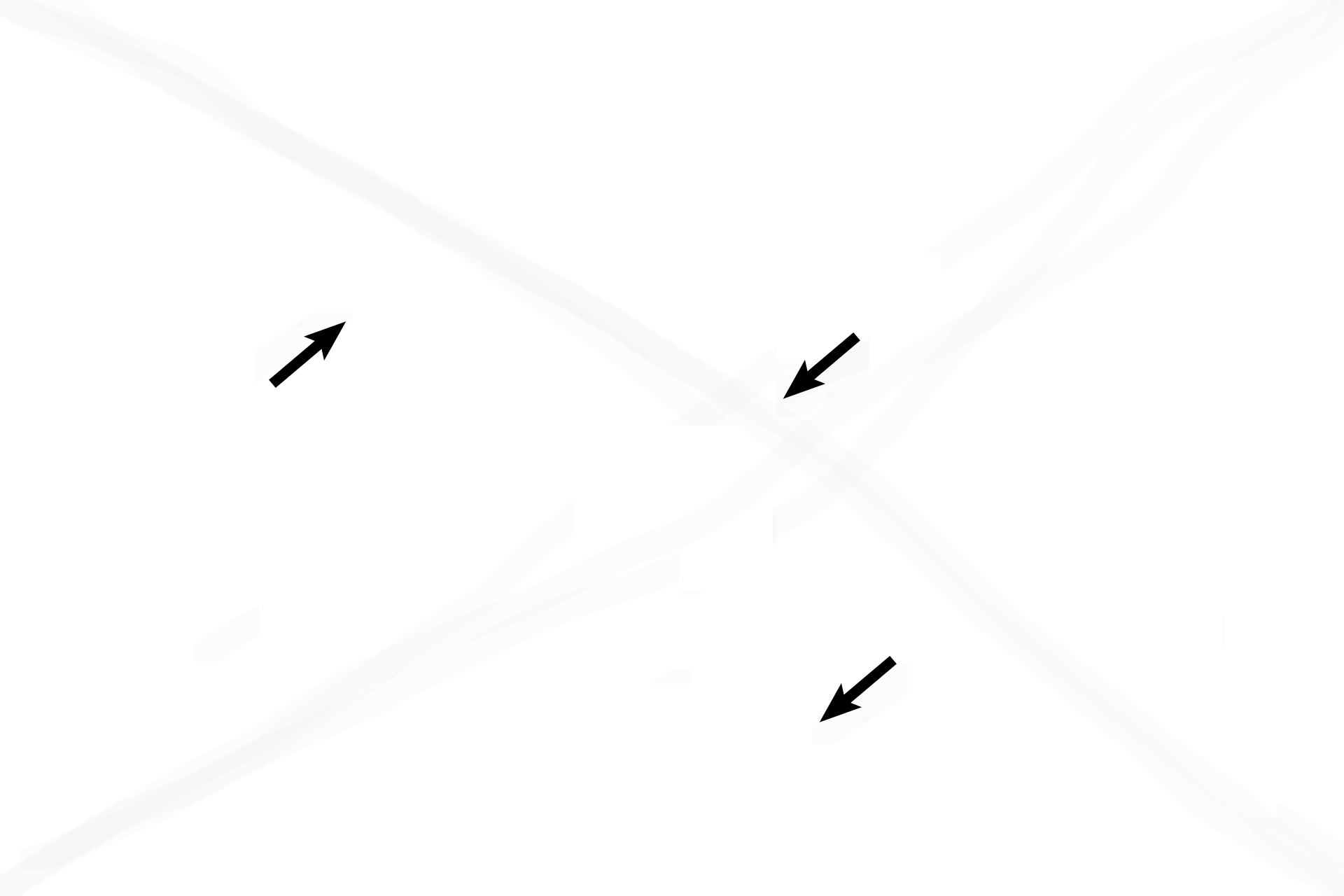 Osteocytes <p>Compact woven bone in the fetus is laid down by the endosteum by intramembranous ossification. This developing bone is being resorbed on its outer surface while bone deposition is occurring on its inner surface. 400x</p>
