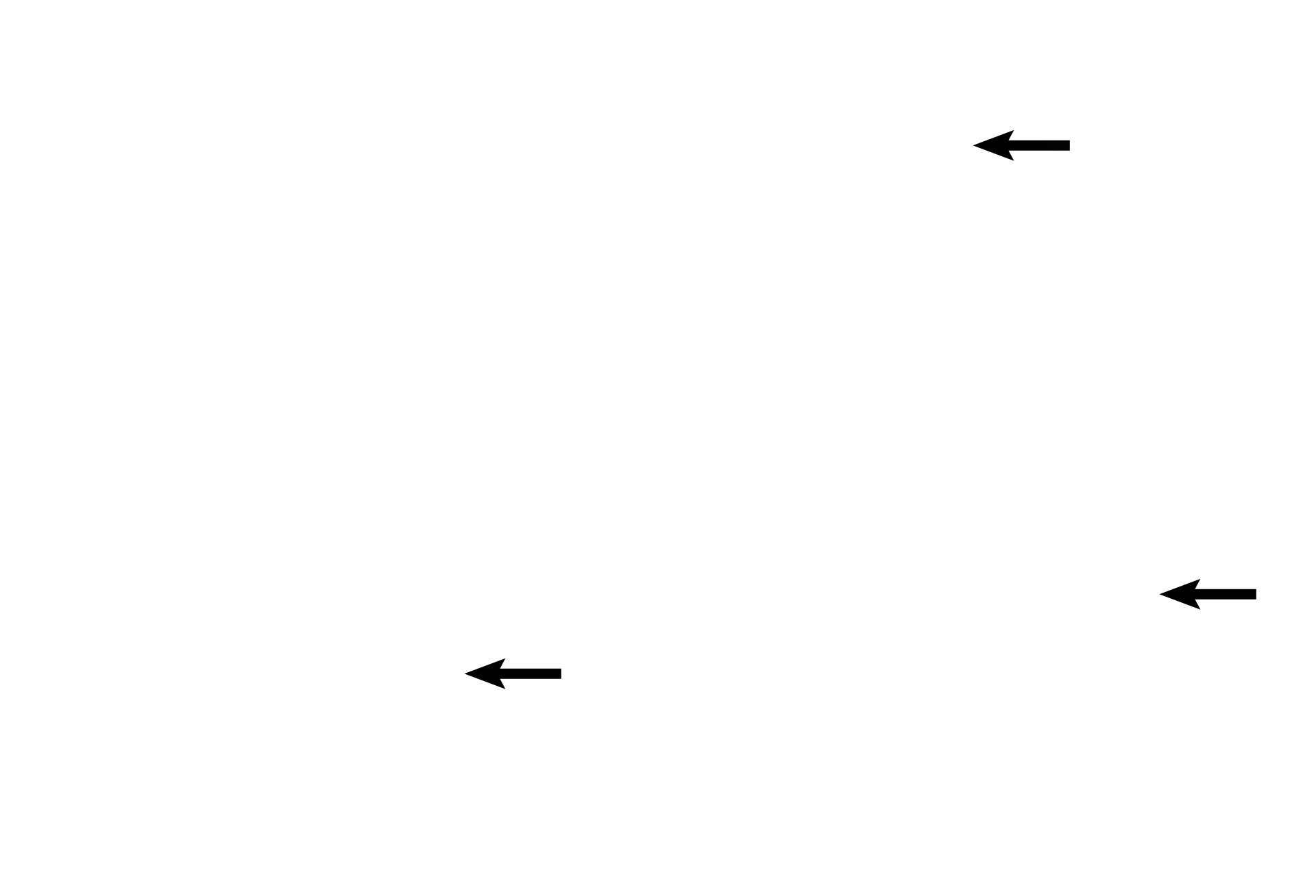 Interlobular connective tissue <p>During pregnancy, the glandular tissue increases in size both by growth and branching of the ducts (estrogen stimulation), as well as by the formation of acini from the ducts (progesterone stimulation). With the branching of the ducts and the appearance of acini, the functional mammary gland now justifies its classification as a compound, tubuloacinar gland. 40x </p>
