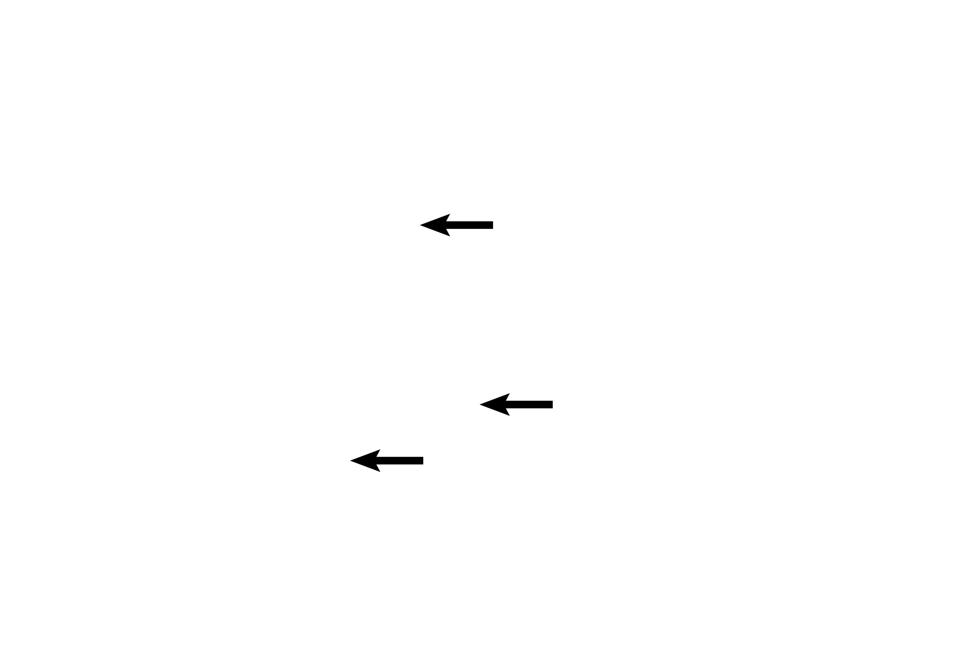 Plasma cells <p>This high magnification image of the connective tissue of the breast during pregnancy shows the accumulation of plasma cells, which secrete antibodies of the IgA class into the milk. These antibodies provide passive immunity to the newborn child. Other cells typical to connective tissue are also visible. 1000x </p>
