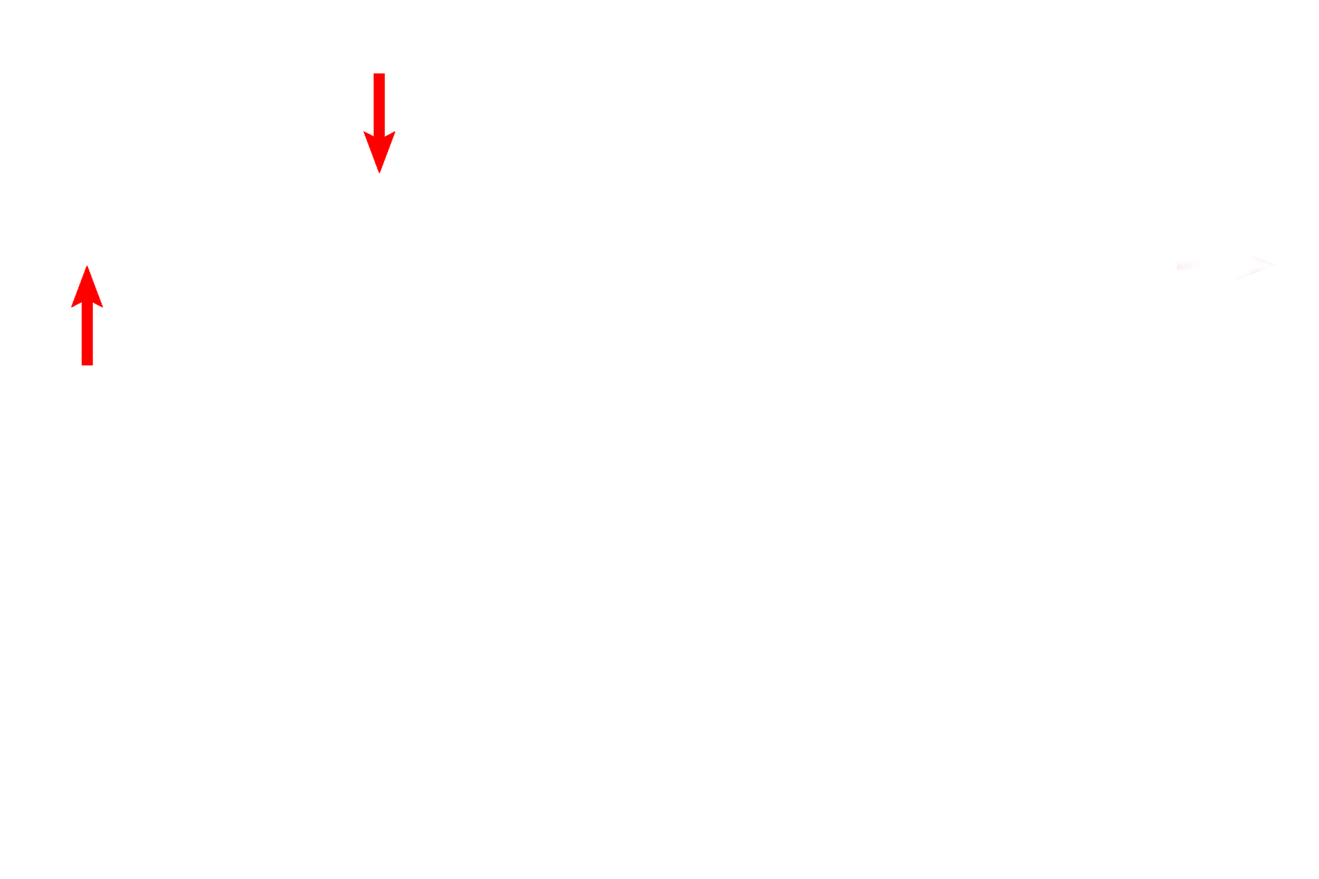 Adipose cells <p>This high magnification image of the connective tissue of the breast during pregnancy shows the accumulation of plasma cells, which secrete antibodies of the IgA class into the milk. These antibodies provide passive immunity to the newborn child. Other cells typical to connective tissue are also visible. 1000x </p>

