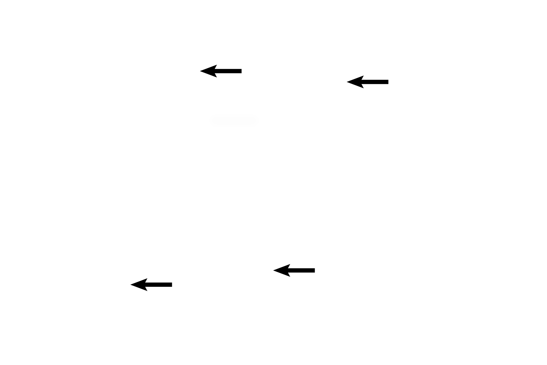  - Acini <p>The lactating stage of the breast is characterized by the large amount of glandular parenchyma relative to the connective tissue and by the presence of widely distended acini. Different lobules of the breast are in different stages of milk production and release.  The acini and ducts are filled with milk. 100x </p>
