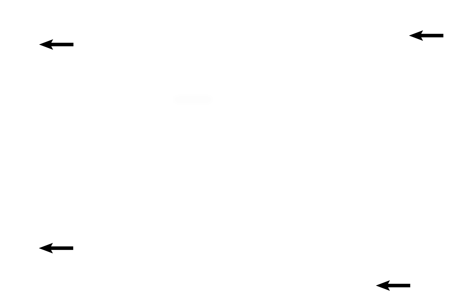 Interlobular connective tissue <p>The lactating stage of the breast is characterized by the large amount of glandular parenchyma relative to the connective tissue and by the presence of widely distended acini. Different lobules of the breast are in different stages of milk production and release.  The acini and ducts are filled with milk. 100x </p>

