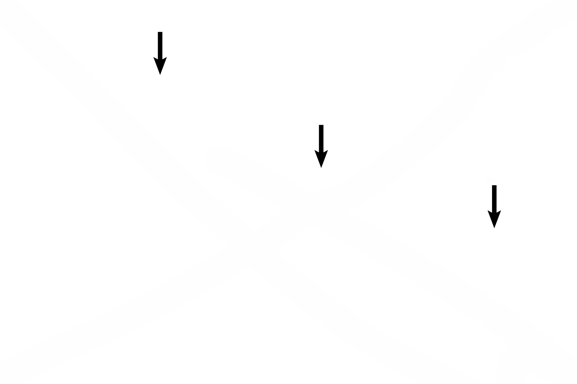  - Germinal epithelium <p>The ovary is covered by a serosa of epithelium overlying a thin connective tissue layer. However, rather than the expected simple squamous epithelium, the epithelium of this serosa is simple cuboidal and is called by the misnomer “germinal epithelium.”  A dense connective tissue layer, tunica albuginea, lies beneath the serosa. Small follicles are located in the cortex beneath the tunica albuginea.  400x</p>
