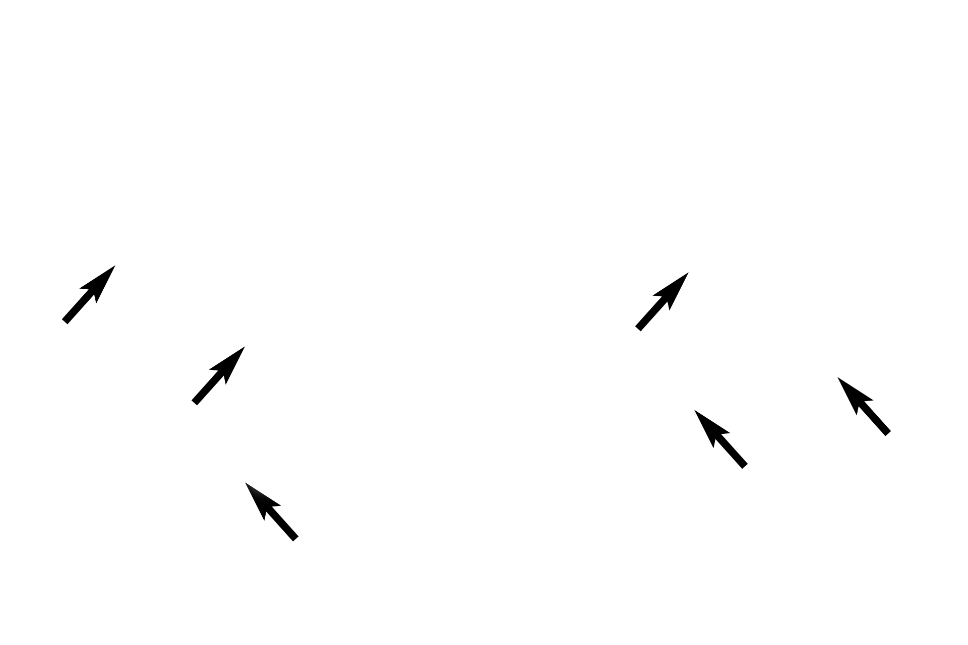 Basal bodies  <p>Two folds of the oviductal mucosa of the ampulla are shown.  The simple columnar epithelium lining the oviduct possesses both ciliated and secretory cells, whose activity is regulated by ovarian hormones.  1000x</p>
